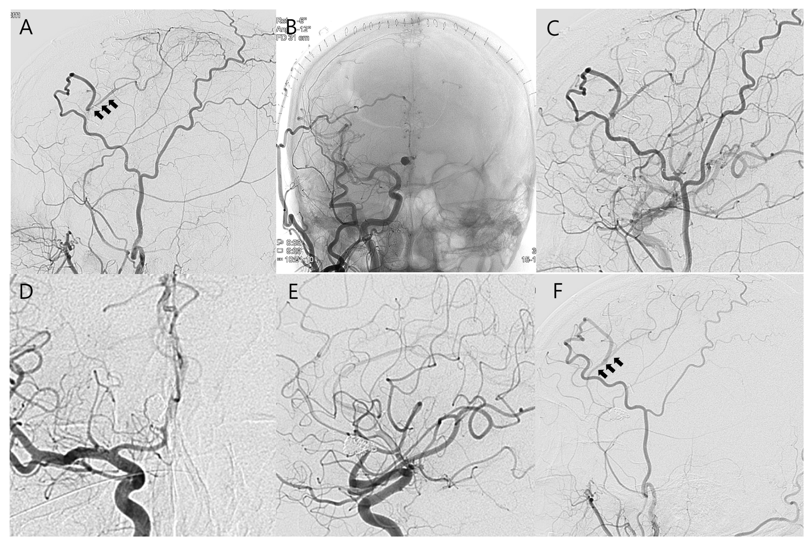 Jcm 14 02927 g003 Jcm 14 02927 g003
