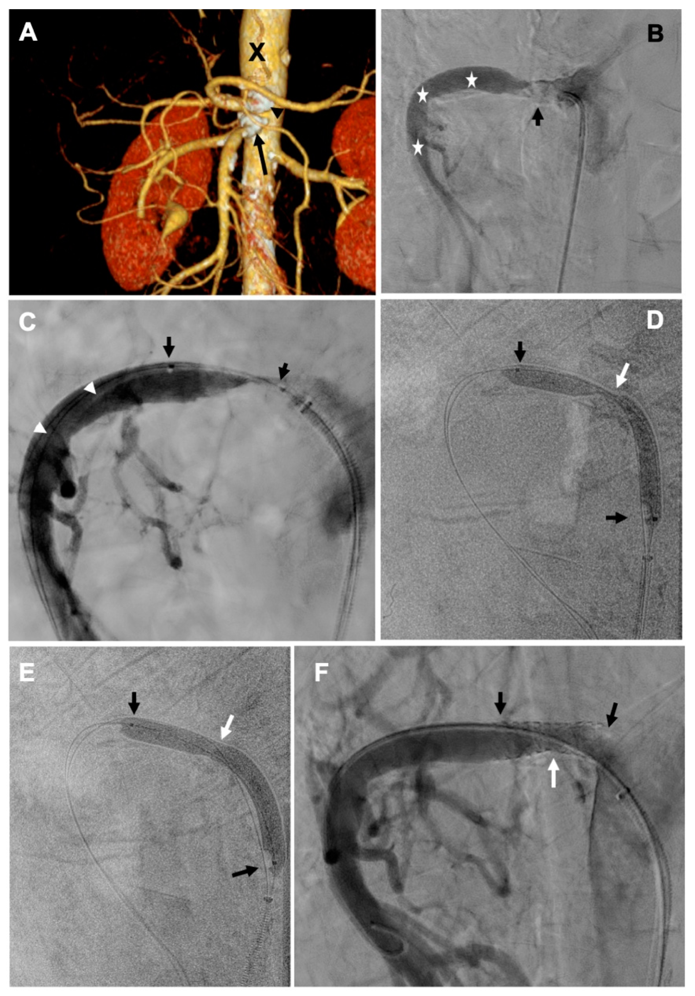 Jcm 14 03014 g001 Jcm 14 03014 g001