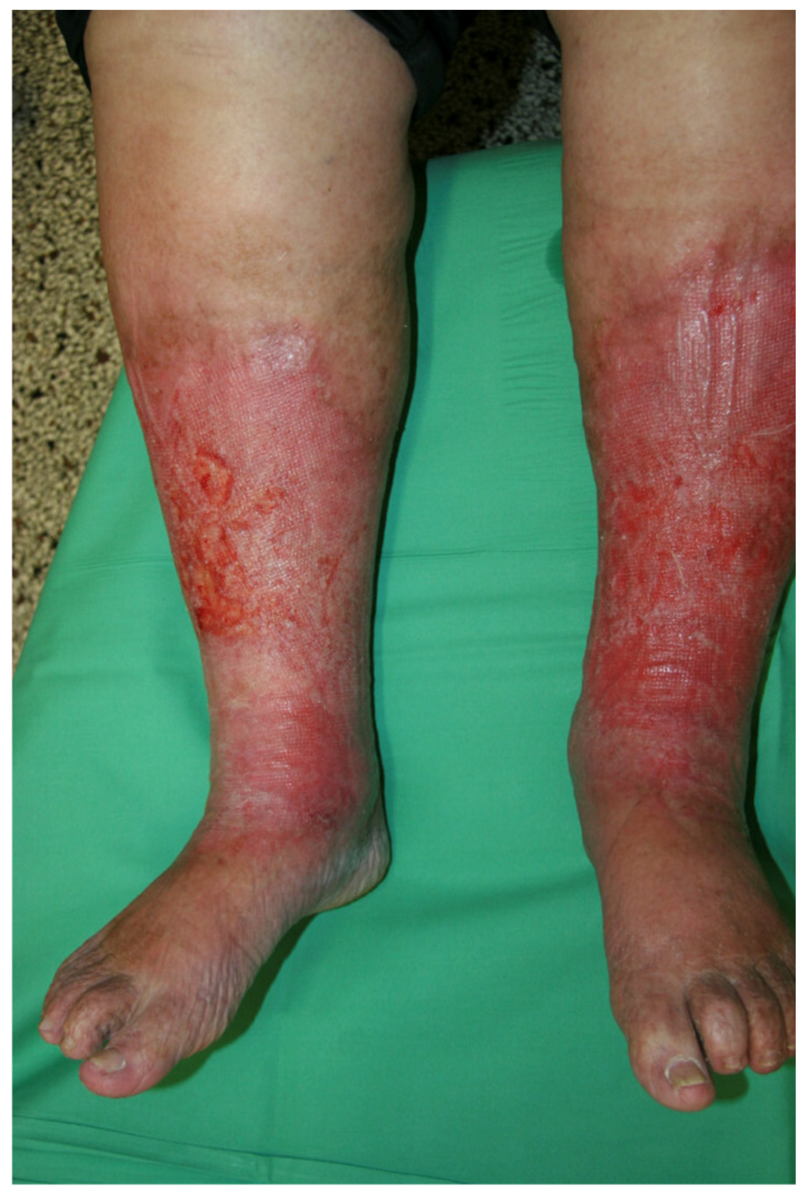 Jcm 14 03321 g002 Jcm 14 03321 g002