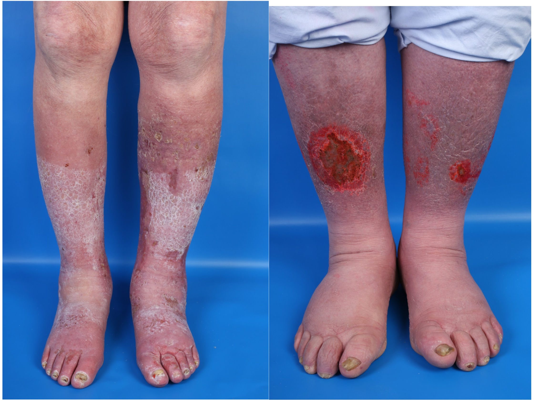 Jcm 14 03321 g004 Jcm 14 03321 g004