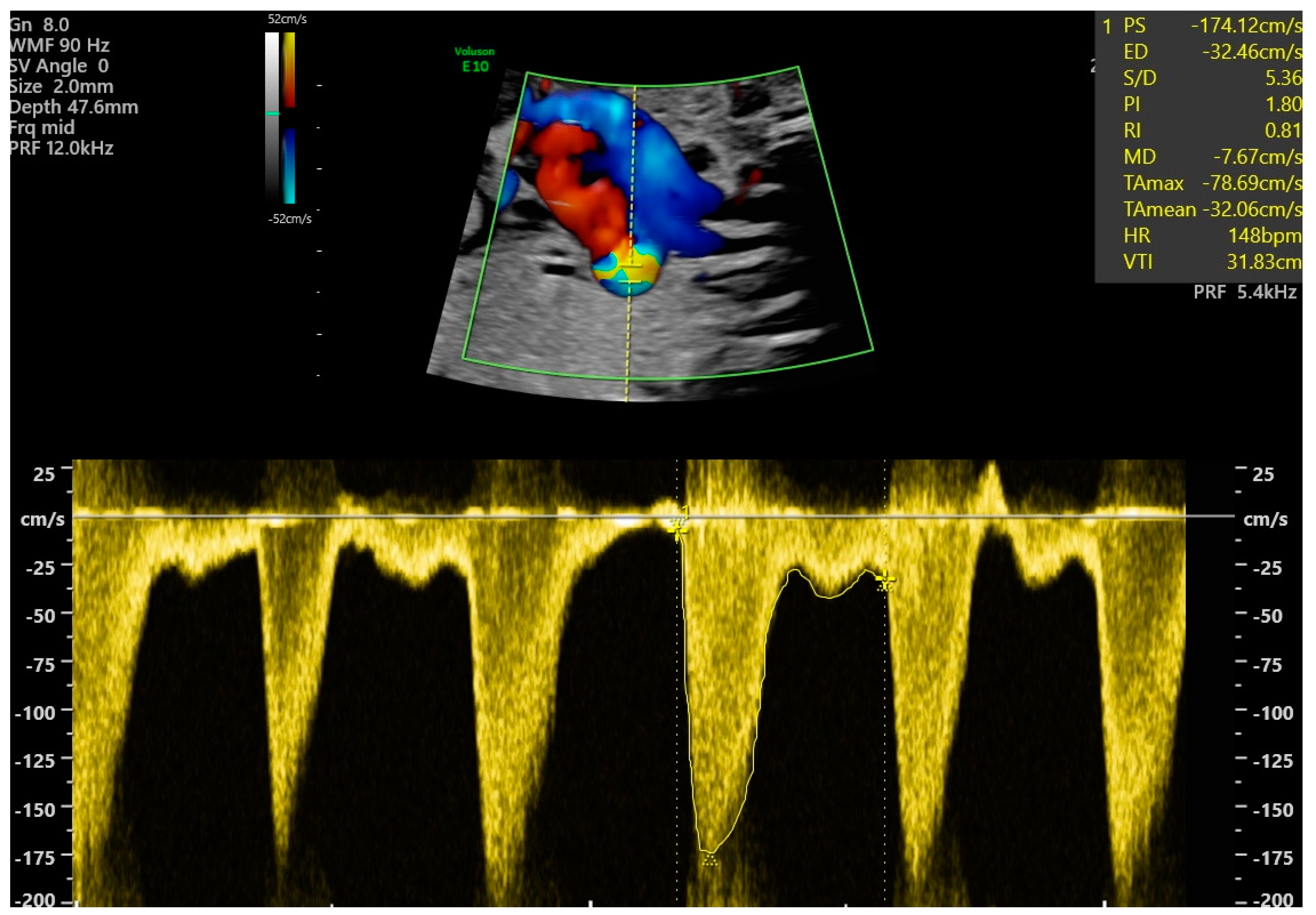 Jcm 14 03388 g001 Jcm 14 03388 g001