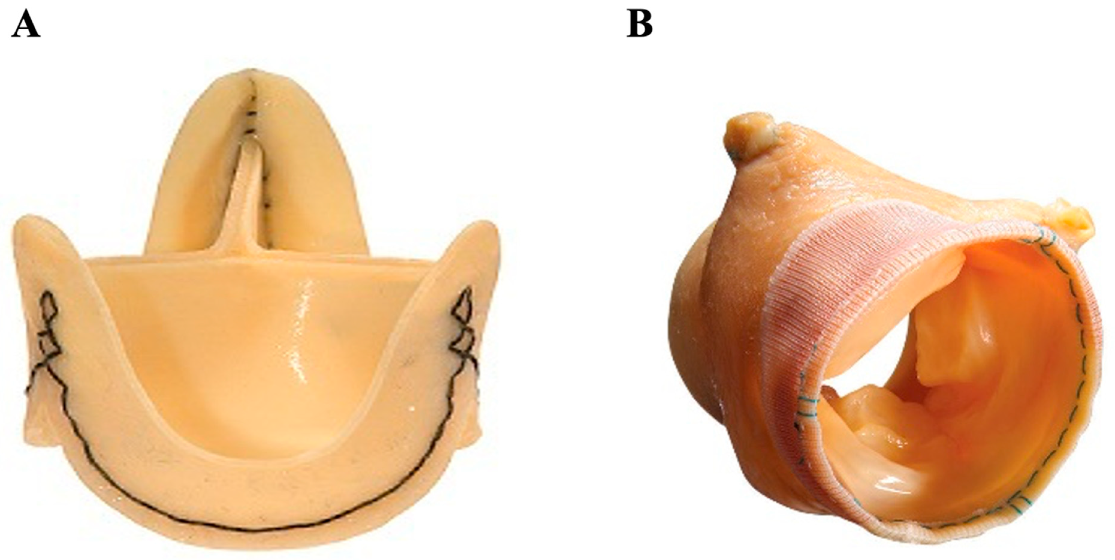 Jcm 14 03499 g004 Jcm 14 03499 g004