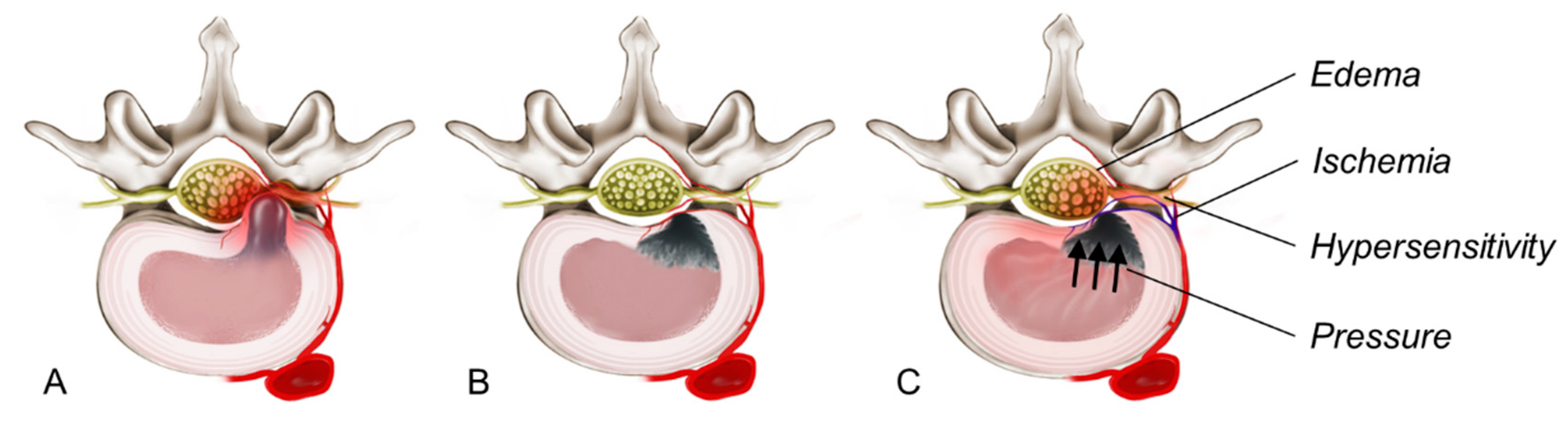 Jcm 14 03529 g002 Jcm 14 03529 g002