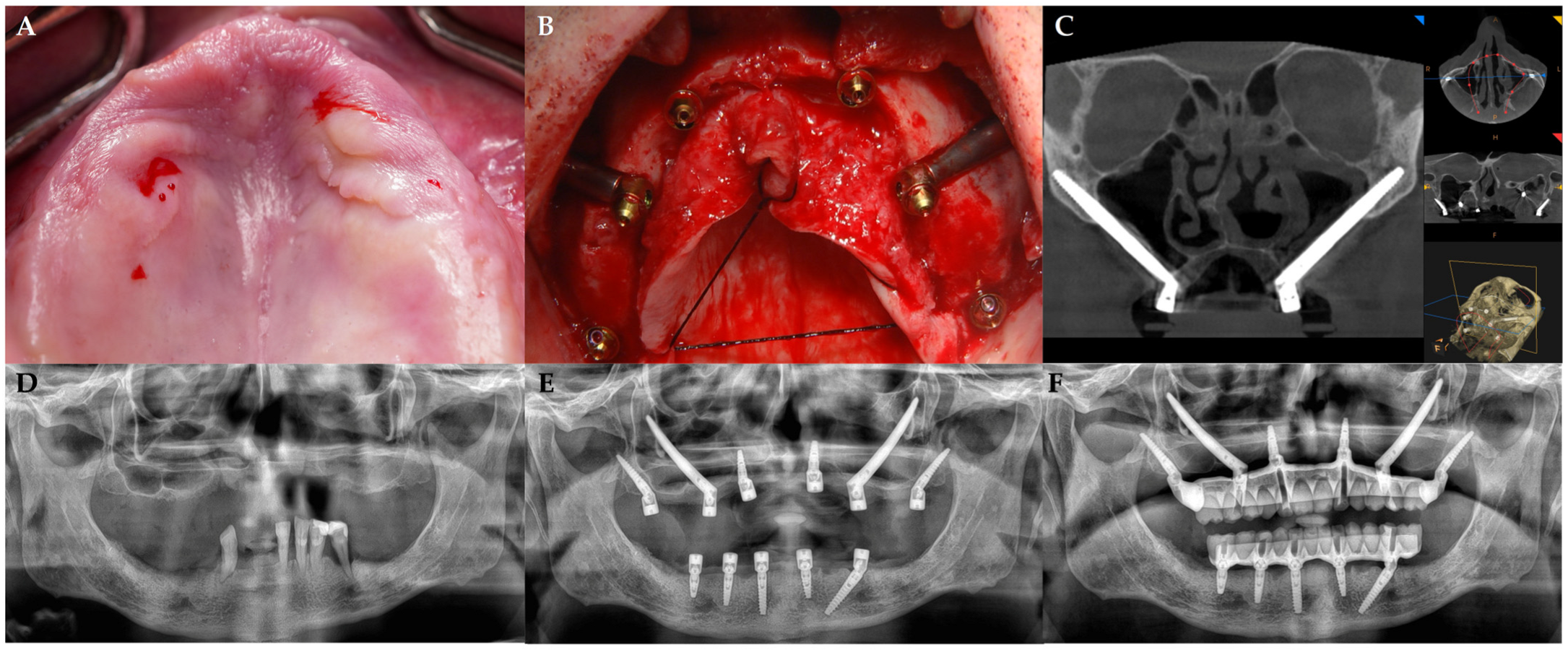 お値下げ相談可能！MAXILLA-ORIENTED IMPLANTOLOGY Maxilla-Oriented Implantology 多数歯欠損・無歯顎症例への