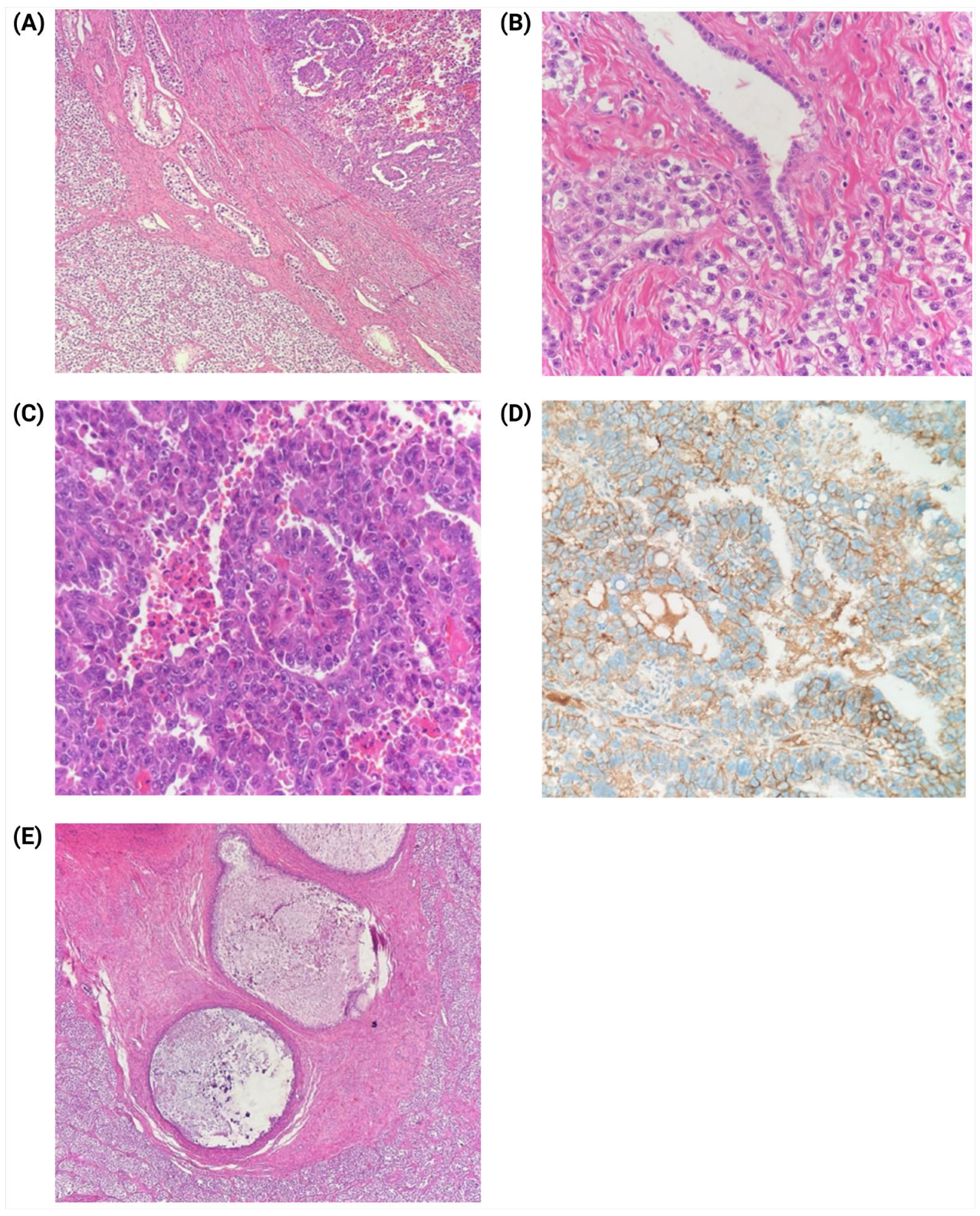 Jcm 14 03564 g004 Jcm 14 03564 g004