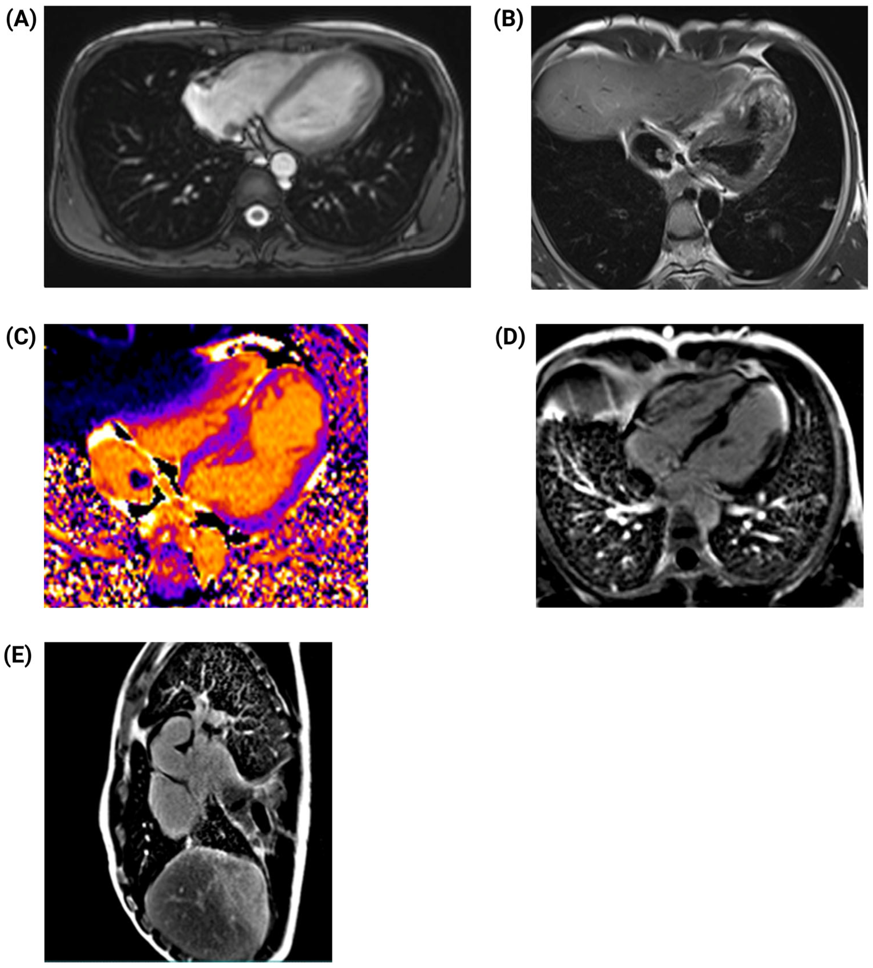 Jcm 14 03564 g005 Jcm 14 03564 g005