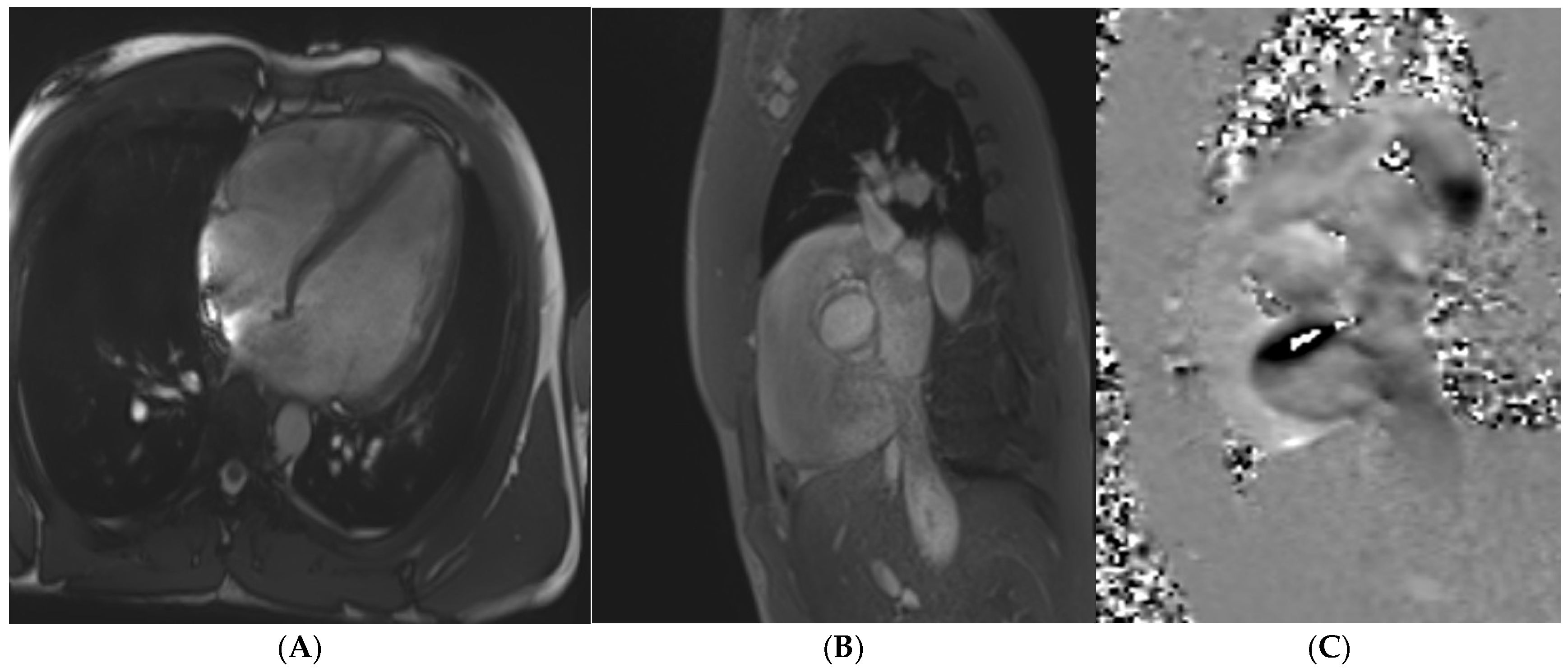 Jcm 14 03576 g005 Jcm 14 03576 g005