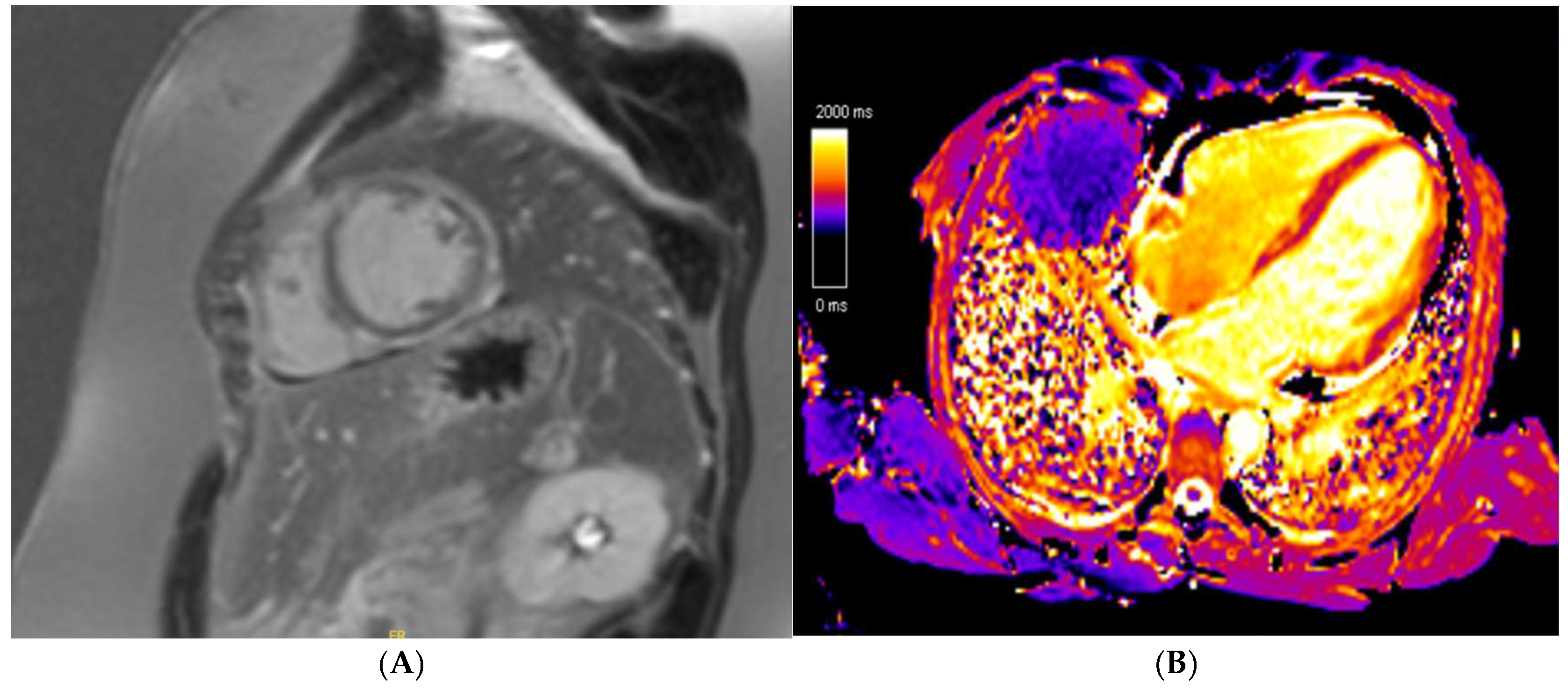 Jcm 14 03576 g006 Jcm 14 03576 g006
