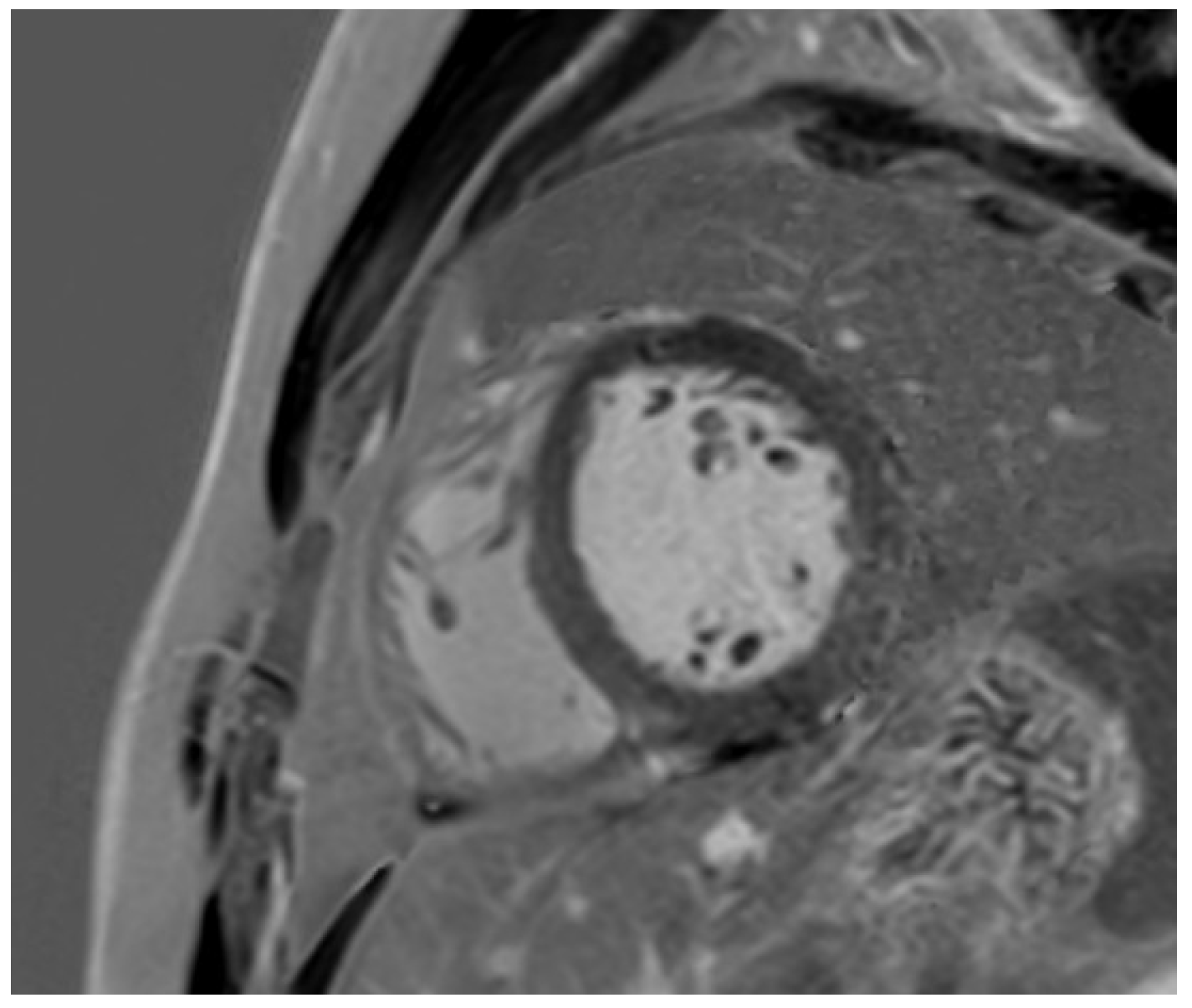 Jcm 14 03576 g007 Jcm 14 03576 g007