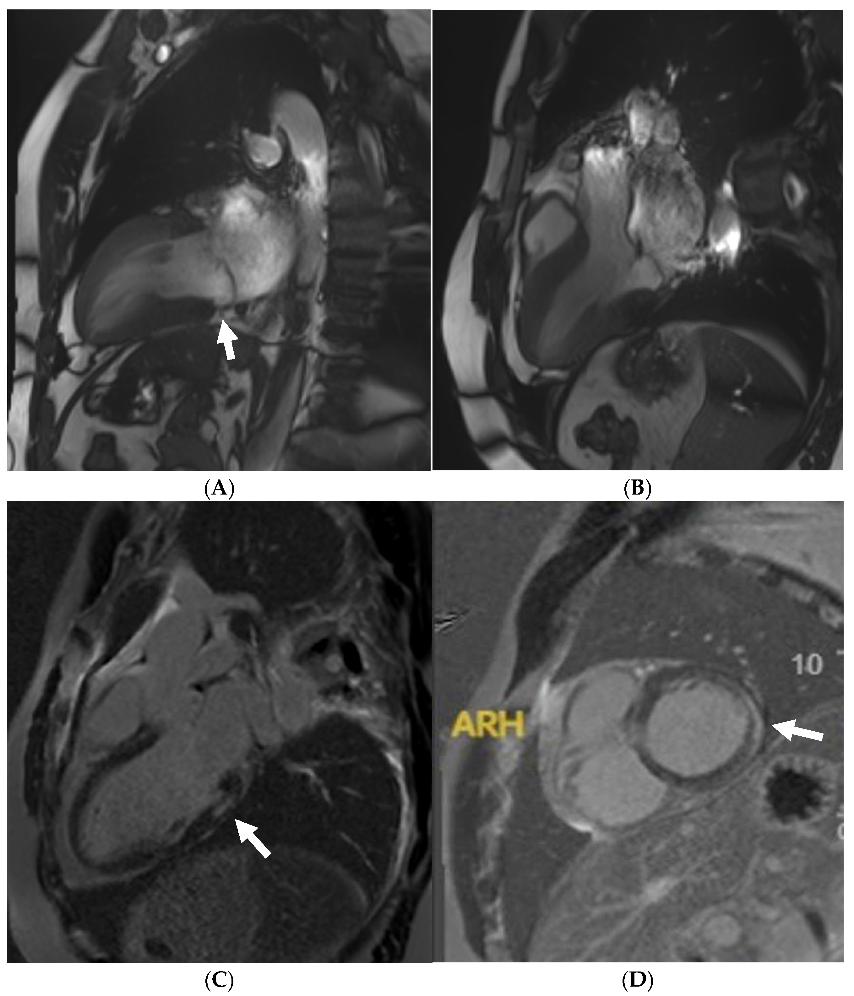 Jcm 14 03576 g009 Jcm 14 03576 g009