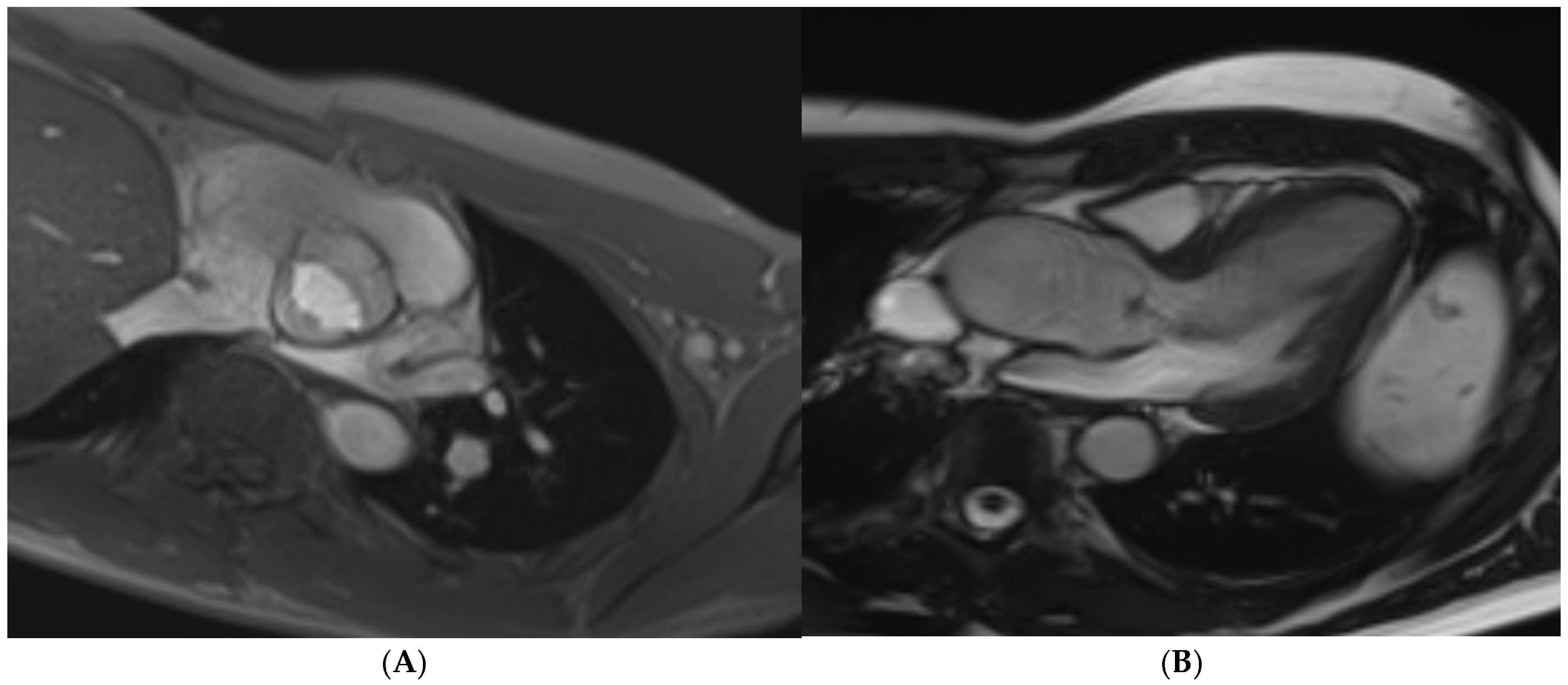 Jcm 14 03576 g010 Jcm 14 03576 g010