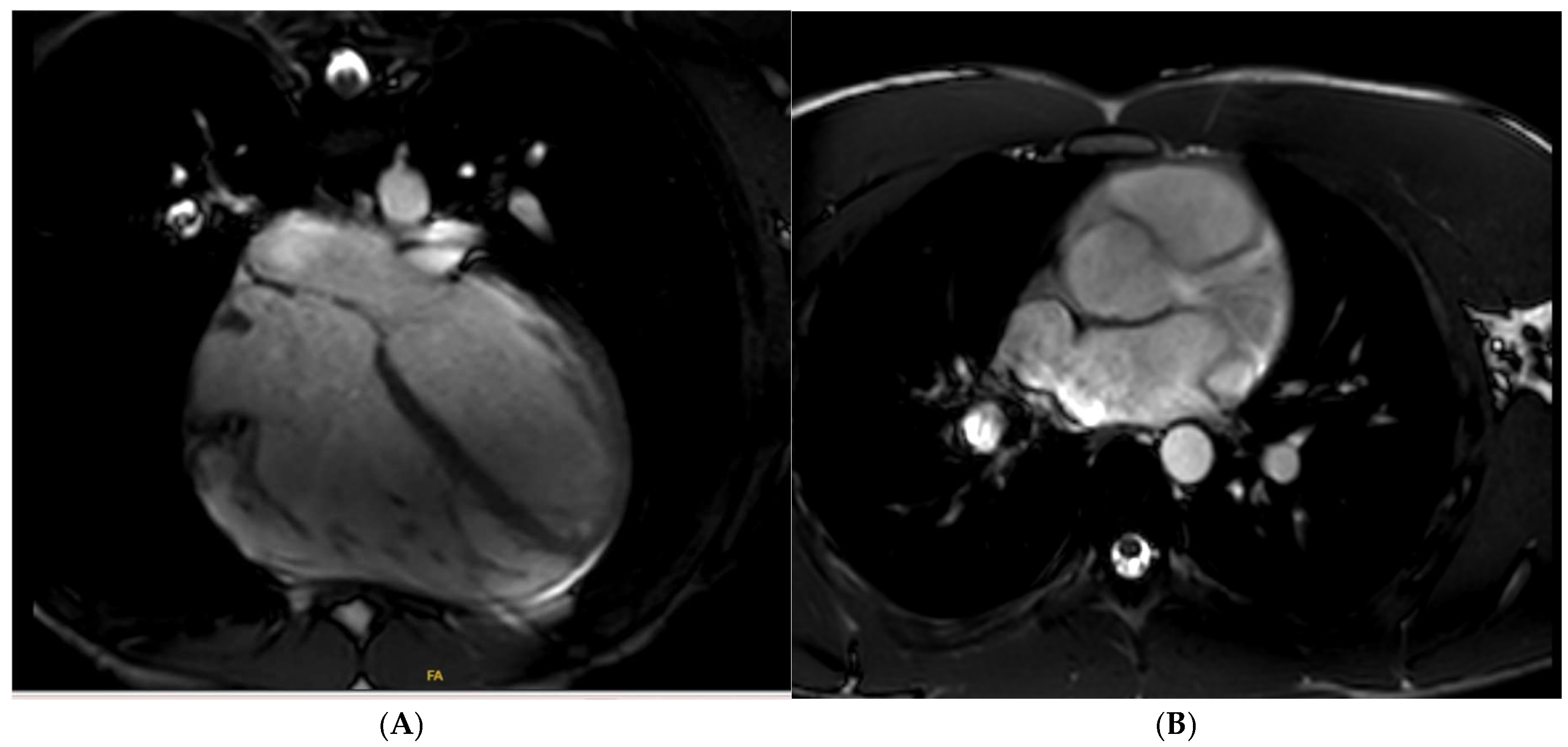 Jcm 14 03576 g012 Jcm 14 03576 g012