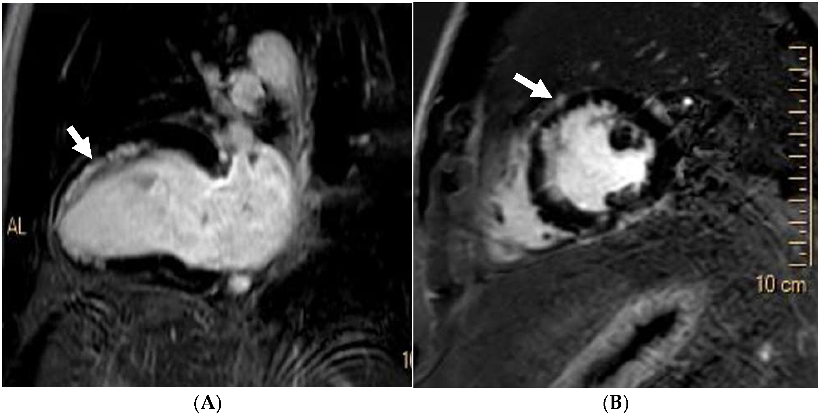 Jcm 14 03576 g013 Jcm 14 03576 g013