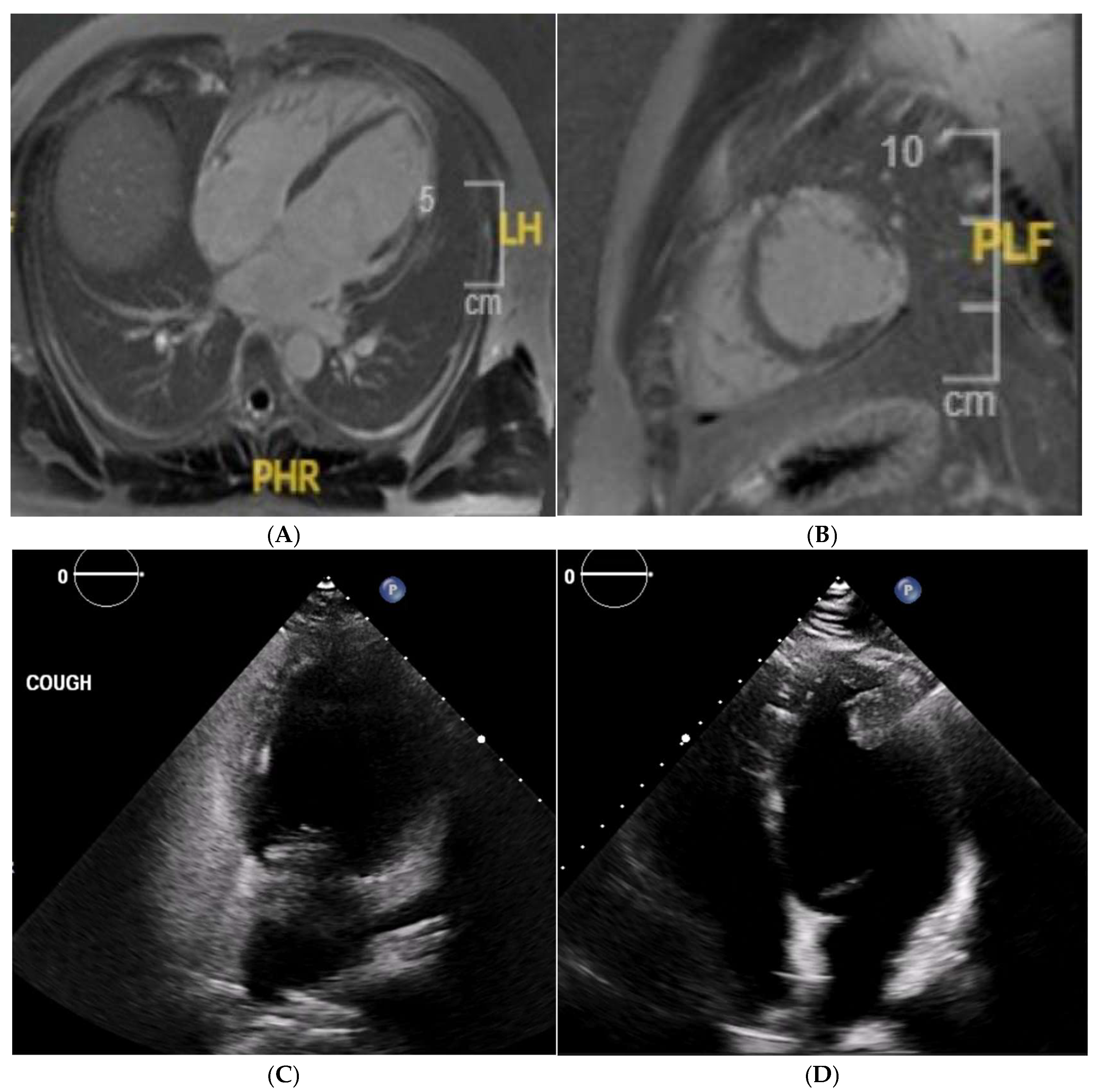 Jcm 14 03576 g014 Jcm 14 03576 g014