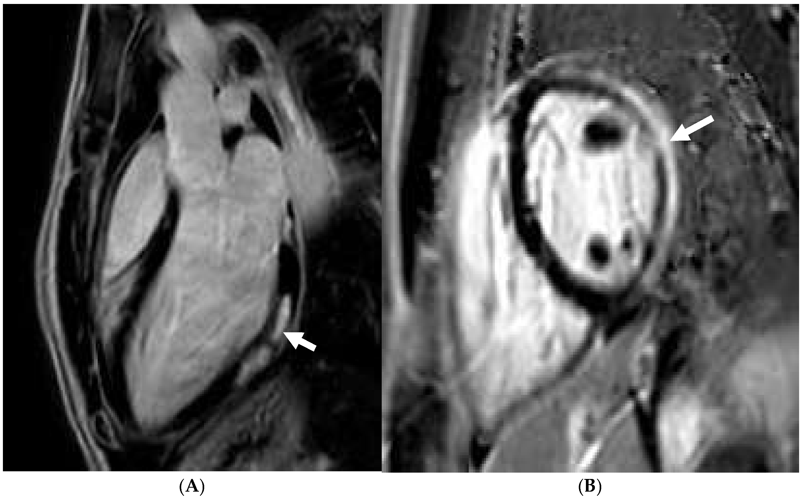 Jcm 14 03576 g015 Jcm 14 03576 g015