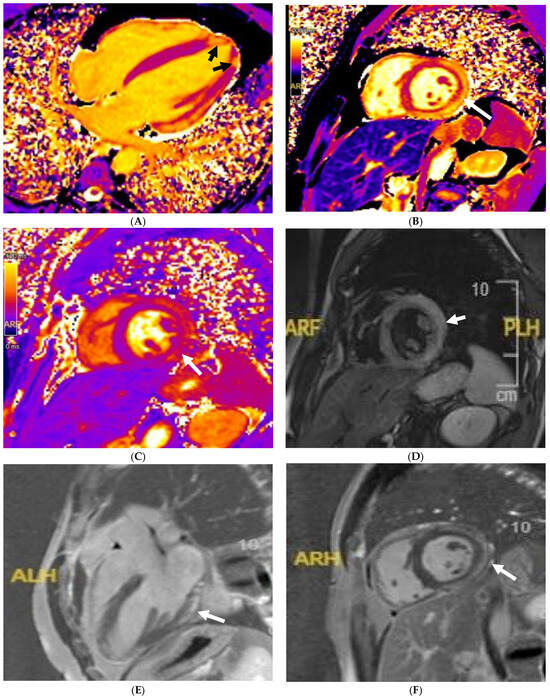 The Role of Cardiovascular Magnetic Resonance Imaging in Athletic ...