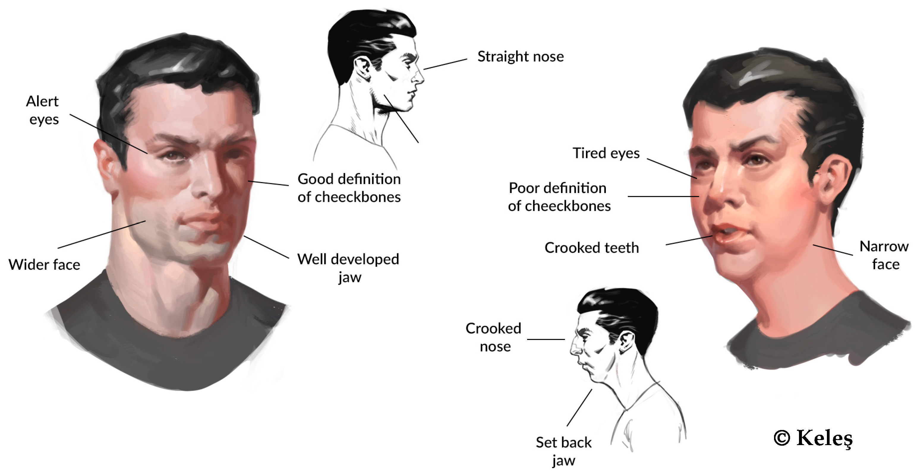 Jcm 14 03586 g003 Jcm 14 03586 g003