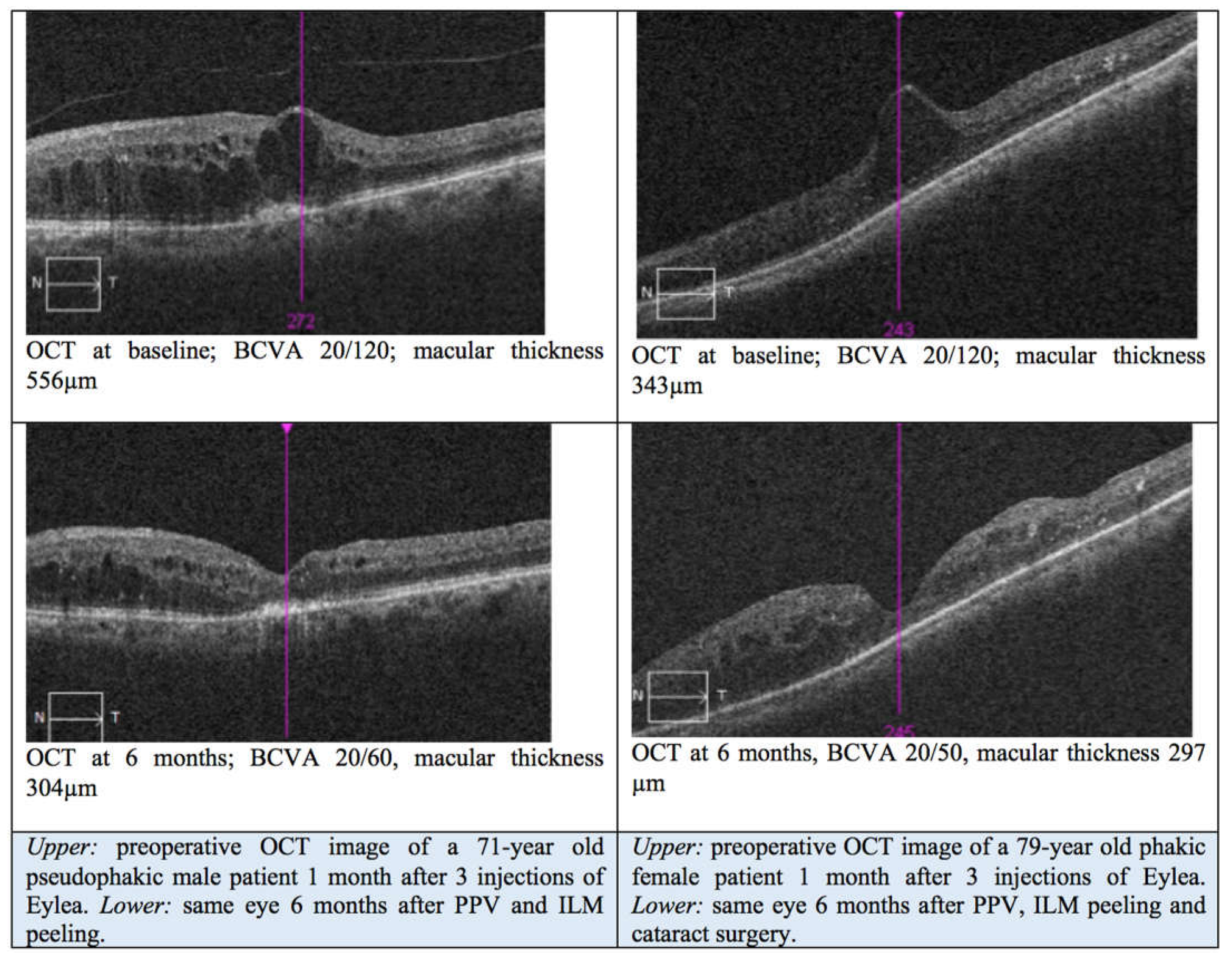 Jcm 14 03686 g001 Jcm 14 03686 g001
