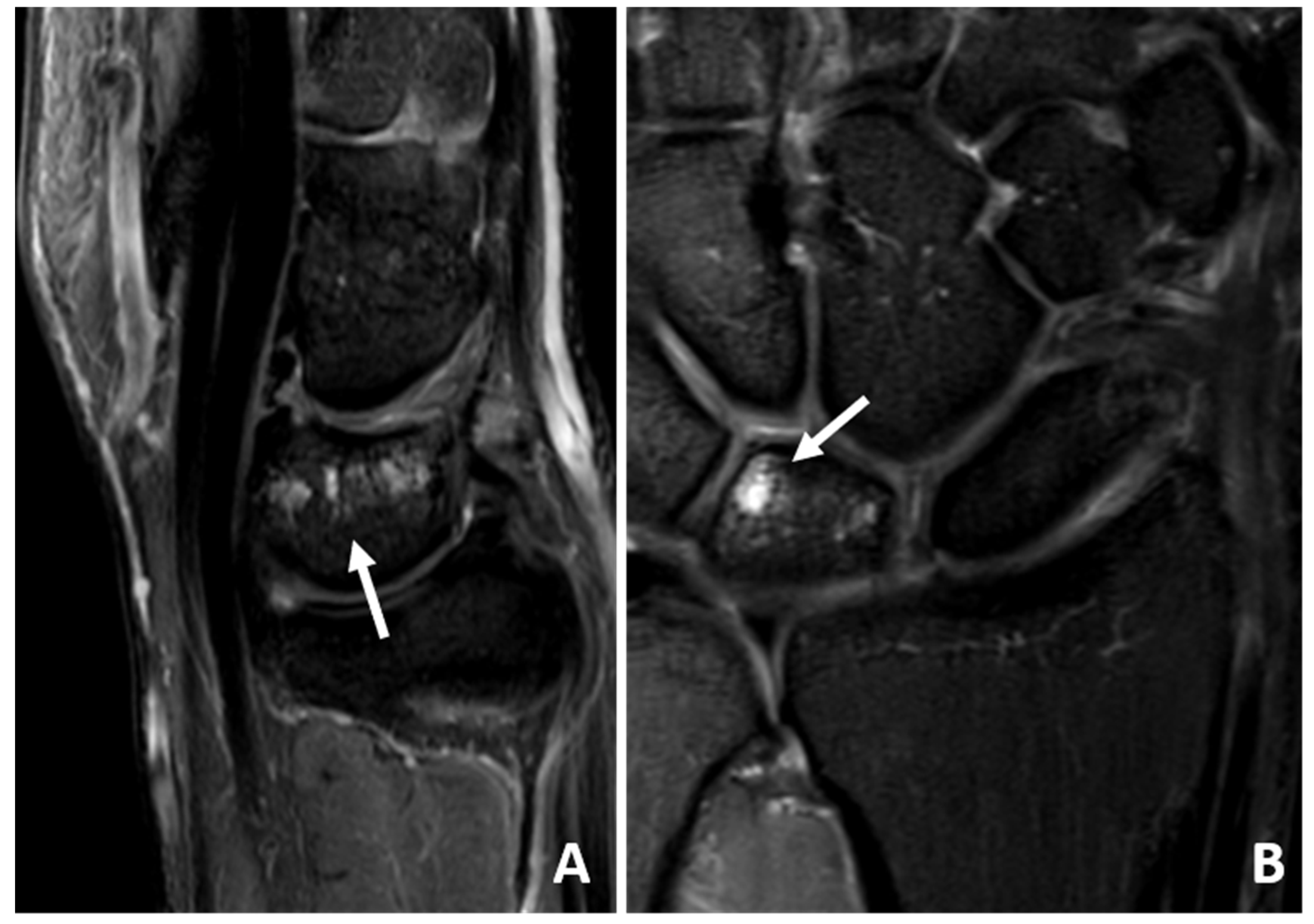 Jcm 14 03729 g005 Jcm 14 03729 g005