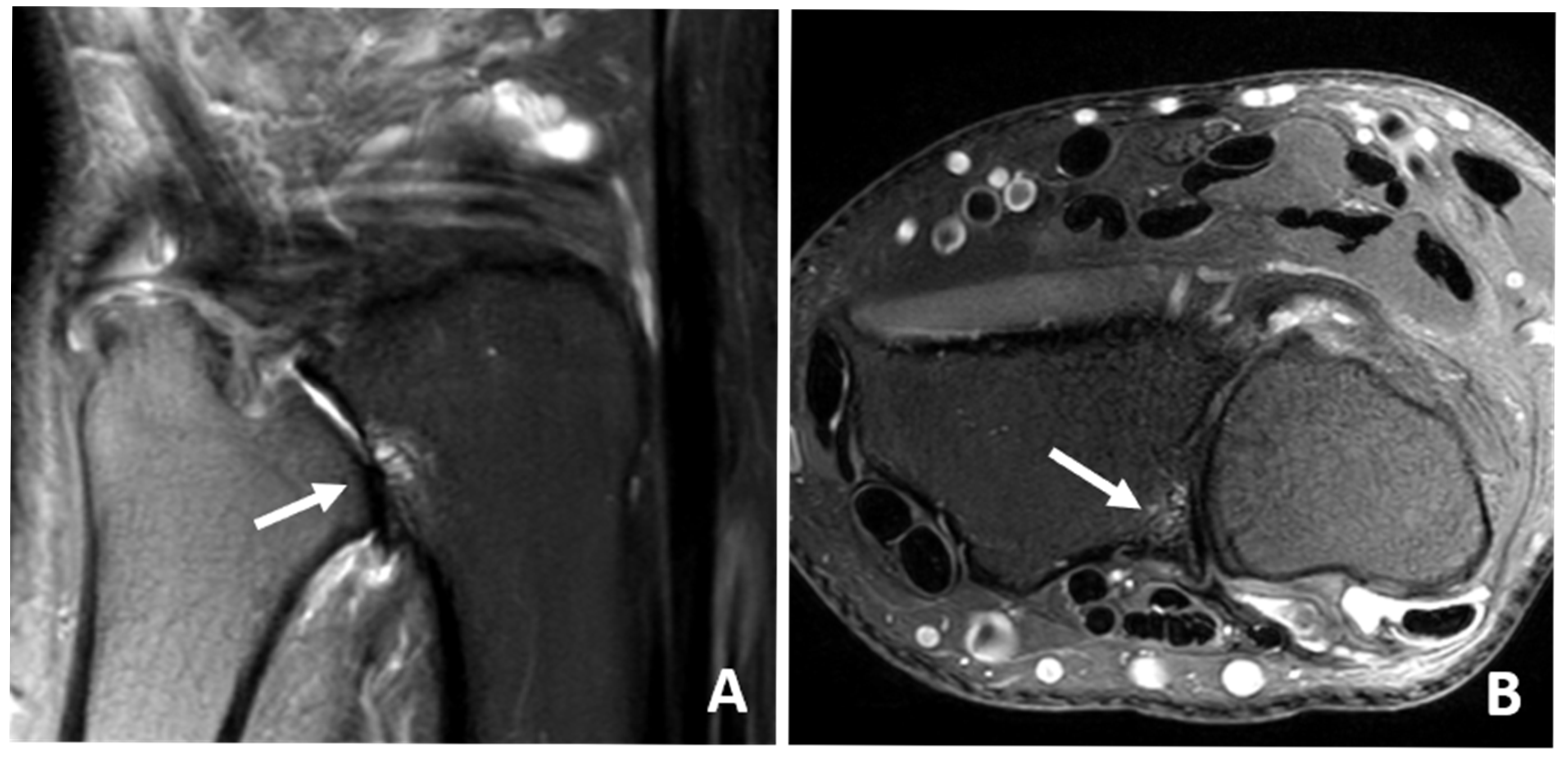 Jcm 14 03729 g006 Jcm 14 03729 g006