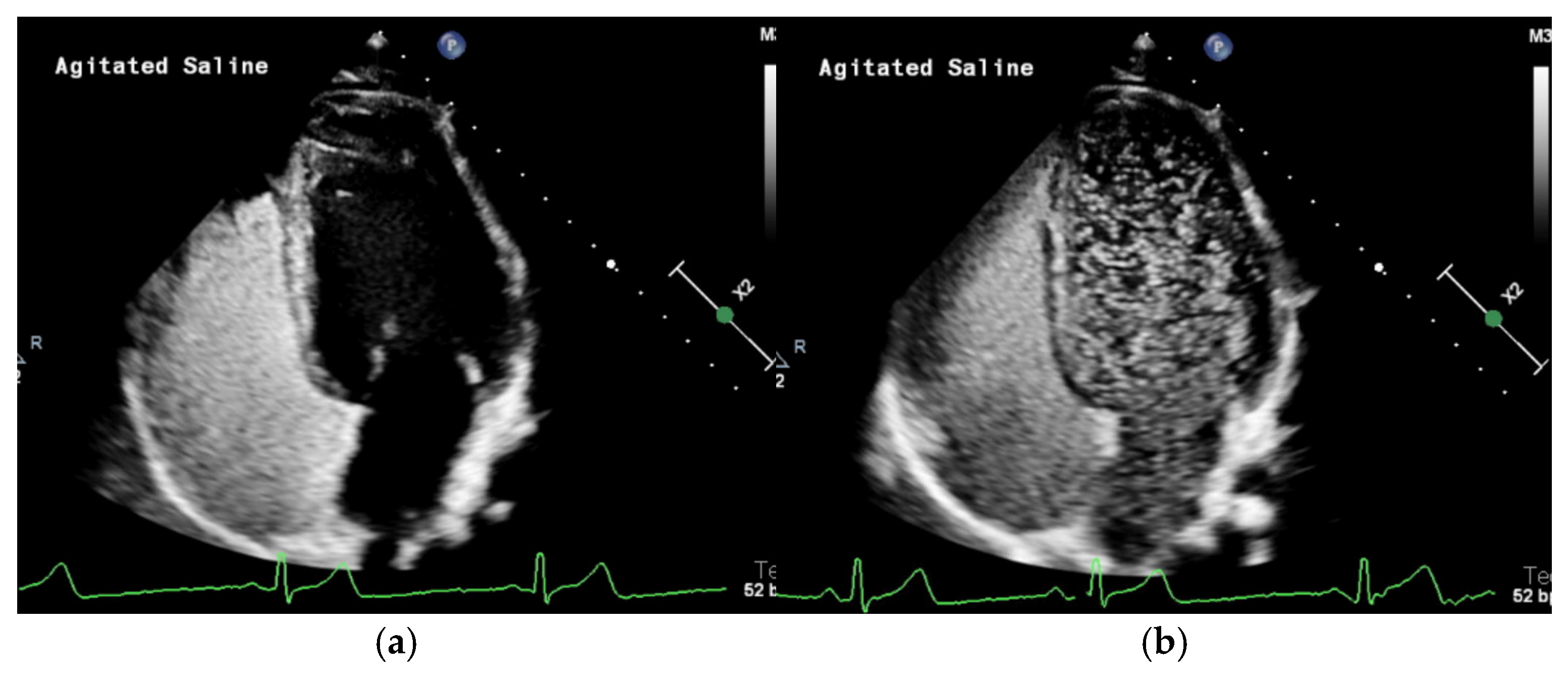 Jcm 14 03739 g002 Jcm 14 03739 g002