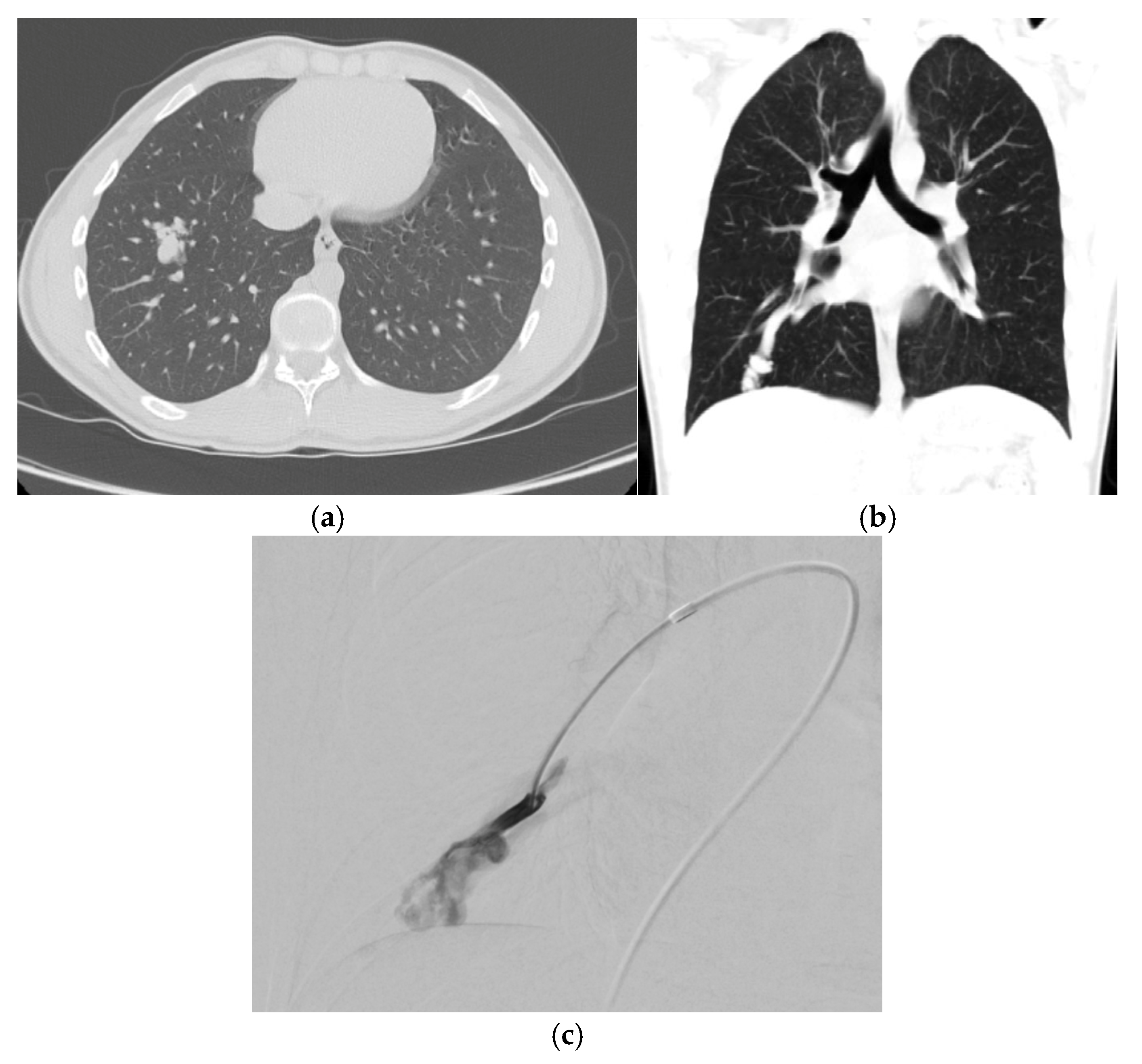 Jcm 14 03739 g003 Jcm 14 03739 g003