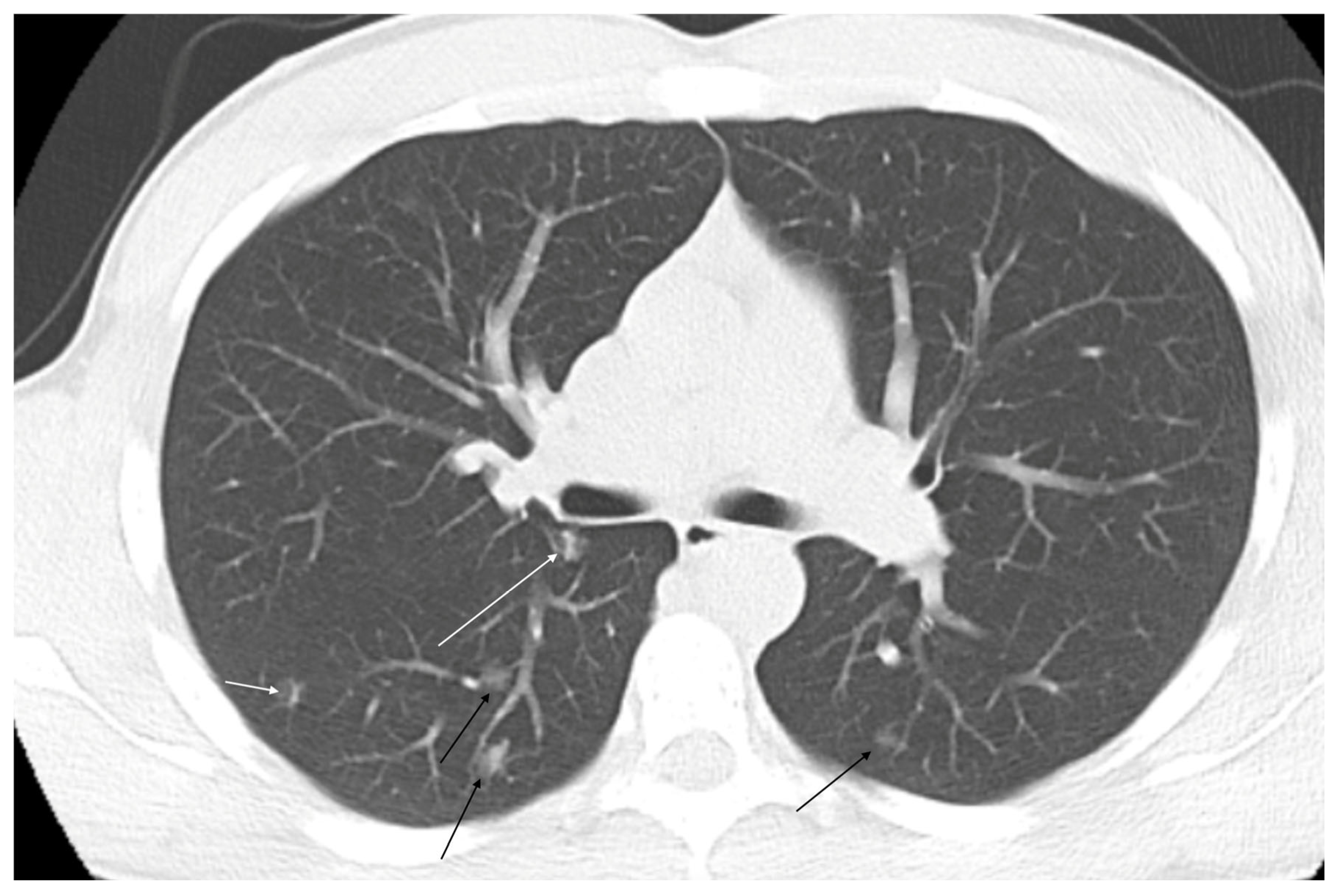 Jcm 14 03739 g004 Jcm 14 03739 g004