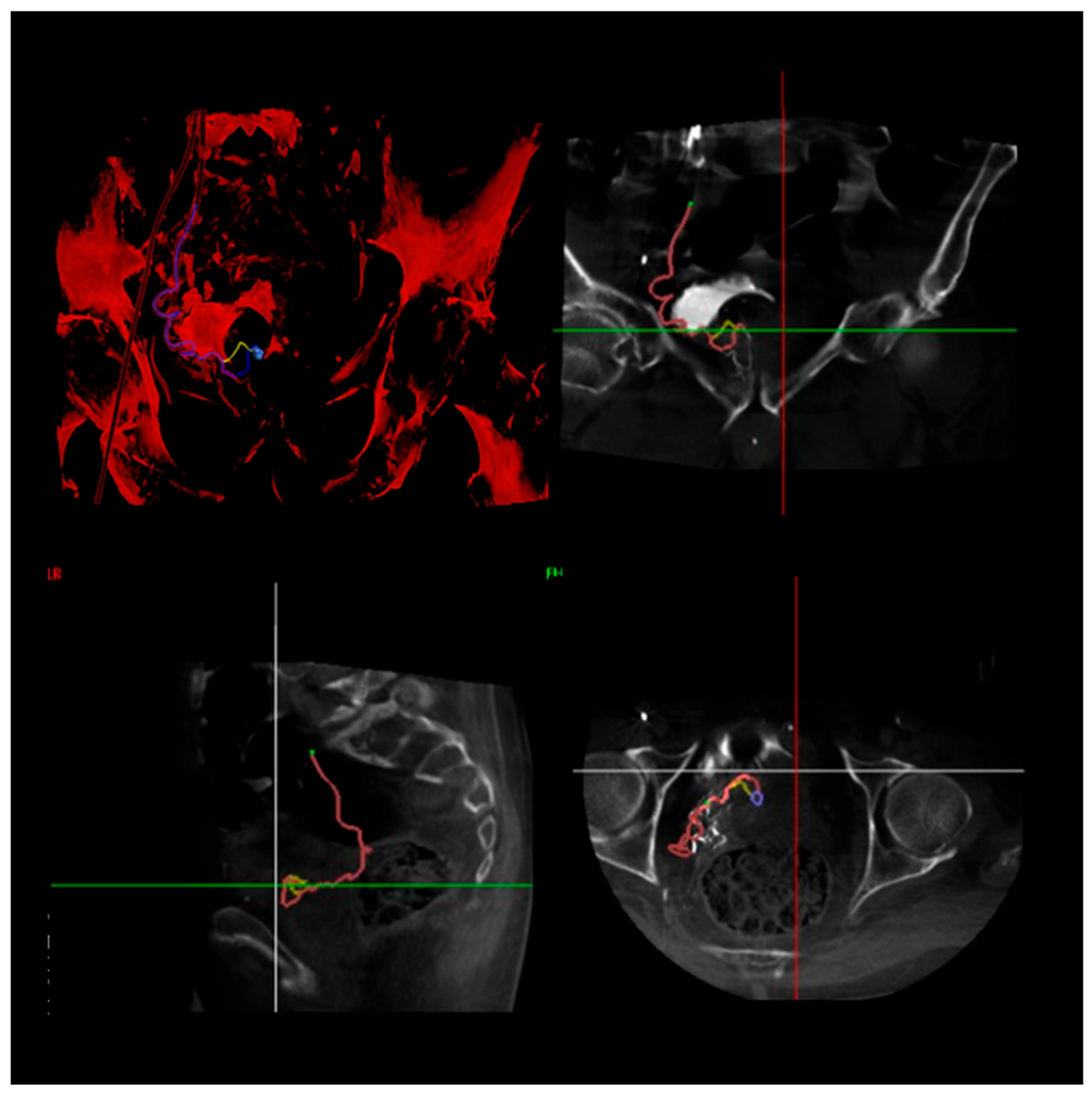 Jcm 14 03775 g001 Jcm 14 03775 g001