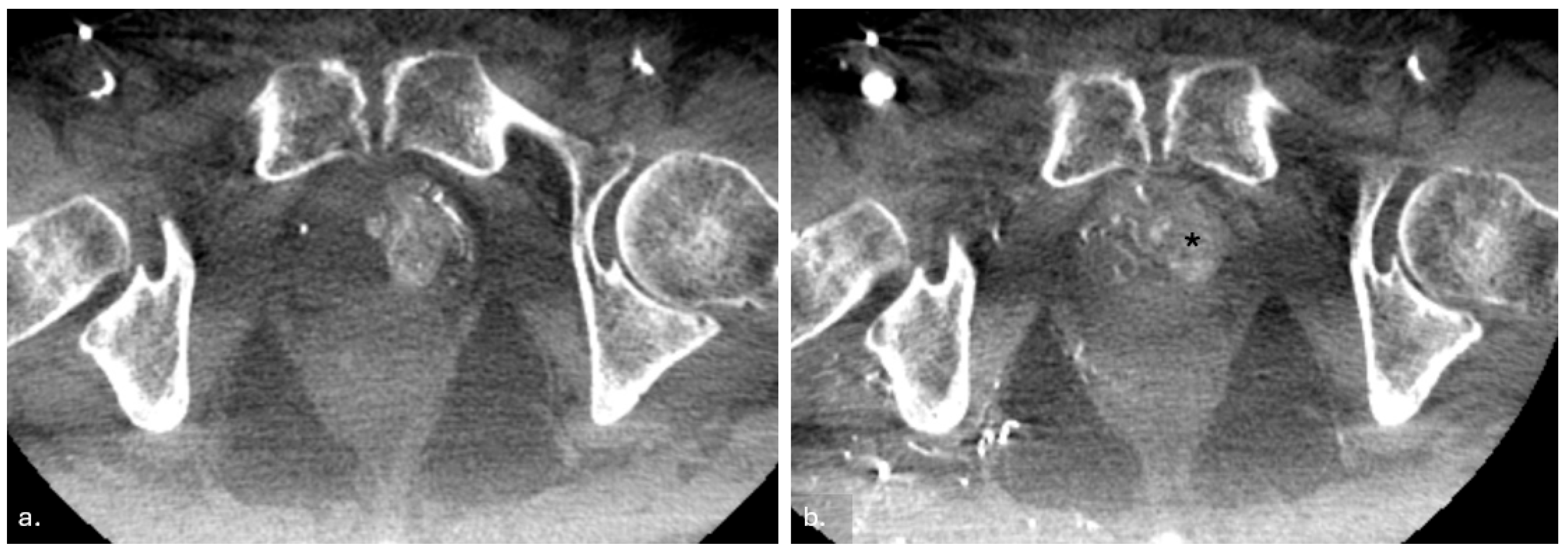 Jcm 14 03775 g003 Jcm 14 03775 g003