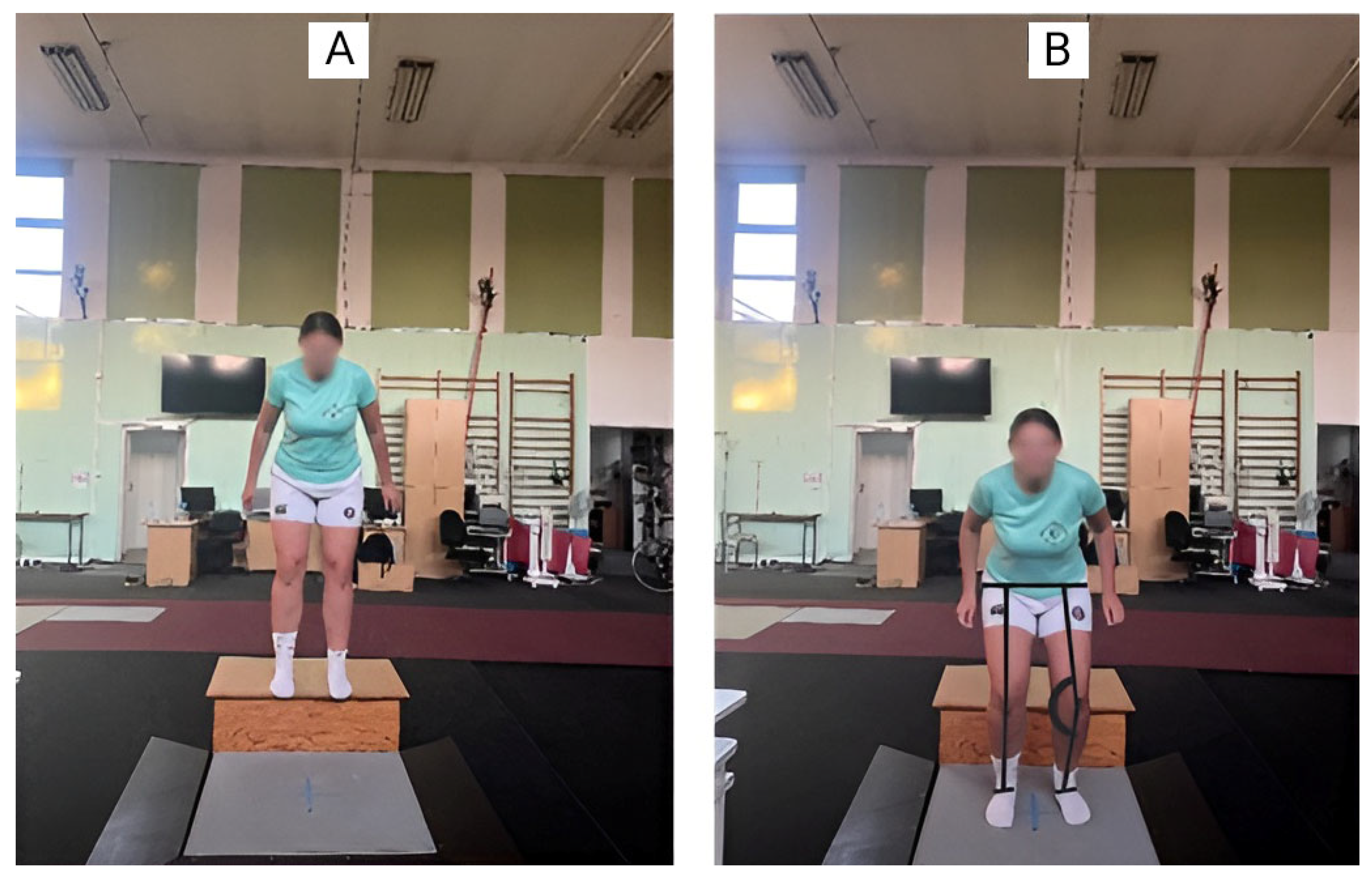 Jcm 14 03779 g001 Jcm 14 03779 g001