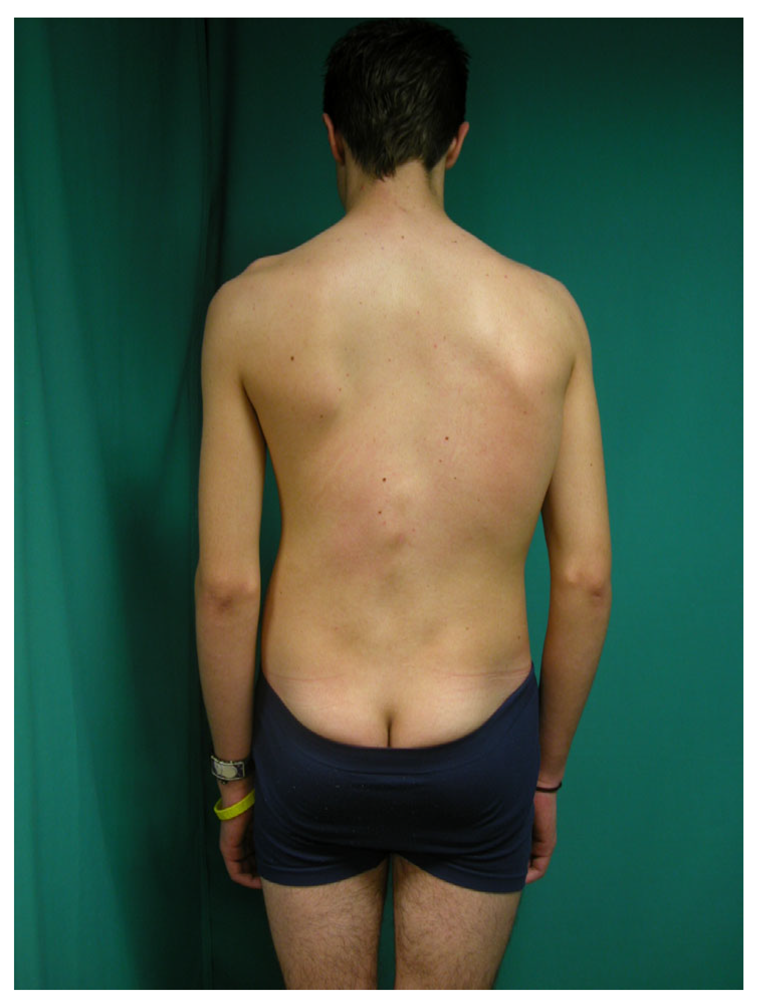 Jcm 14 03870 g001 Jcm 14 03870 g001