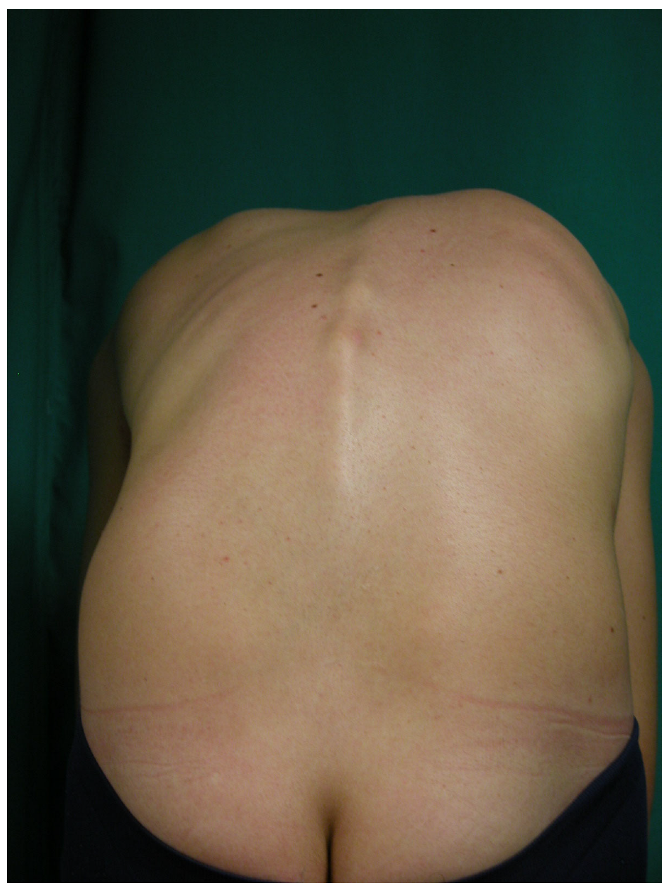 Jcm 14 03870 g002 Jcm 14 03870 g002