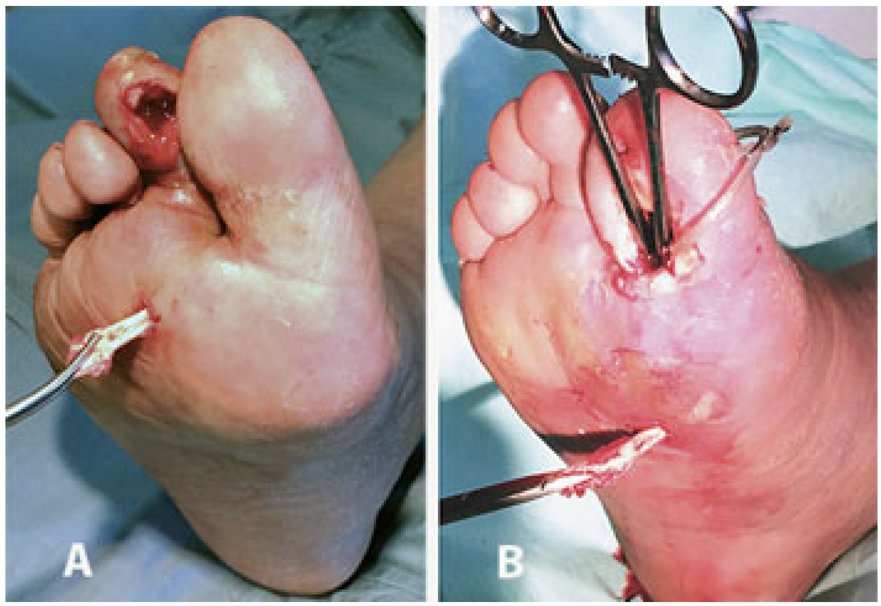 Jcm 14 03918 g007 Jcm 14 03918 g007