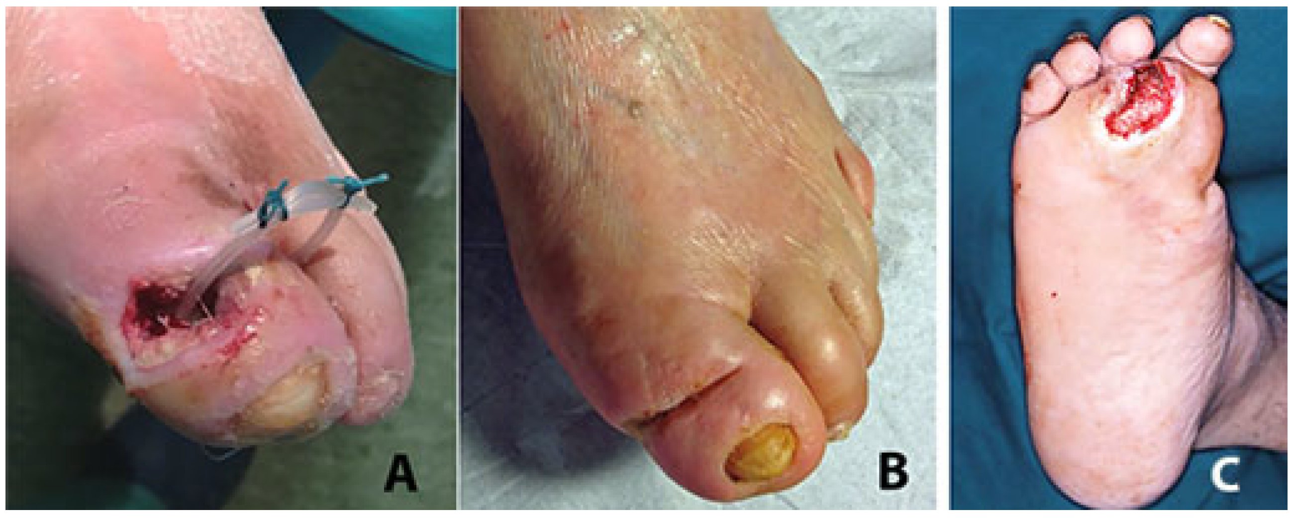 Jcm 14 03918 g010 Jcm 14 03918 g010