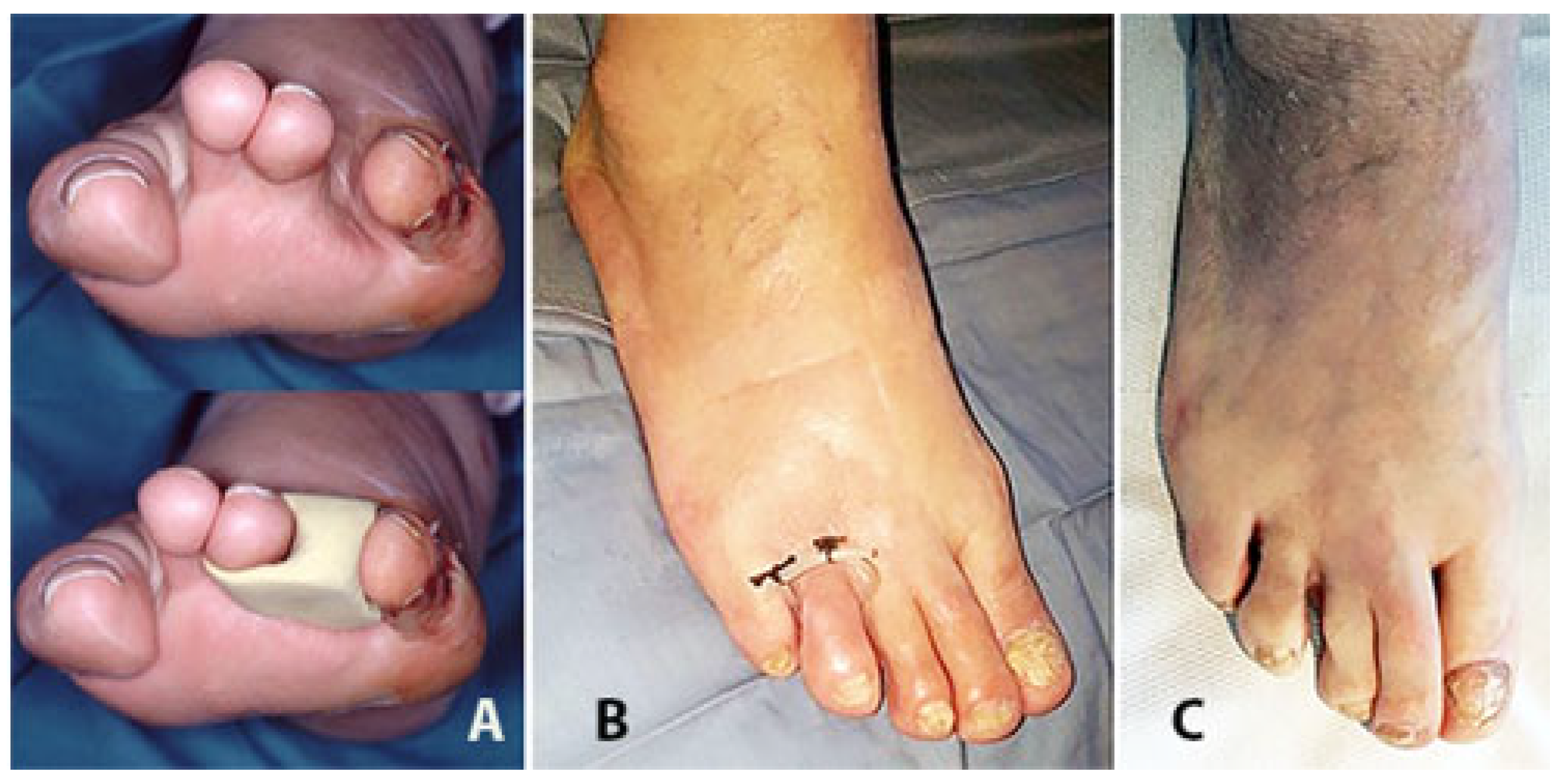 Jcm 14 03918 g011 Jcm 14 03918 g011