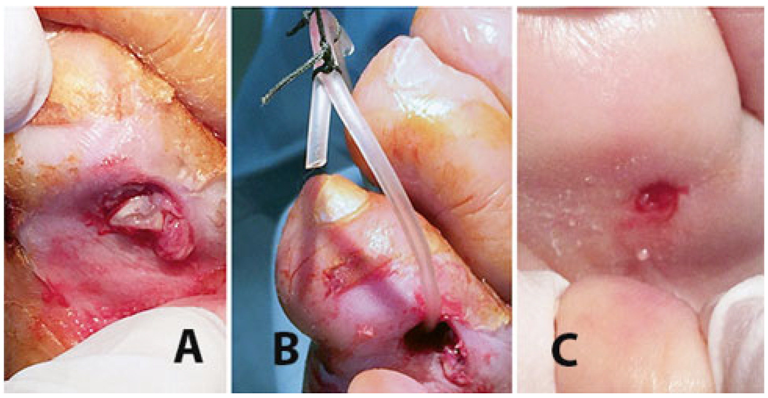 Jcm 14 03918 g012 Jcm 14 03918 g012