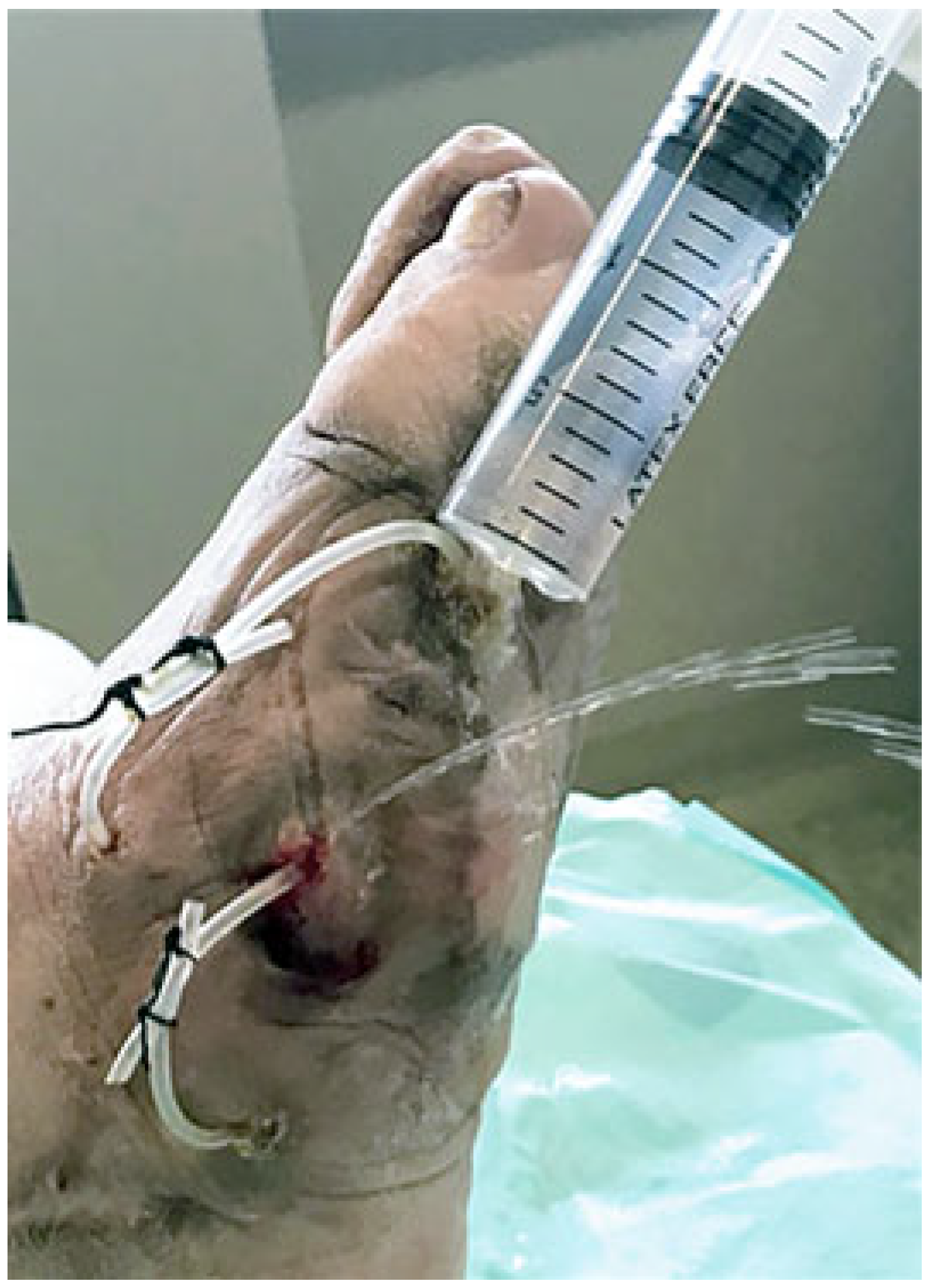 Jcm 14 03918 g013 Jcm 14 03918 g013