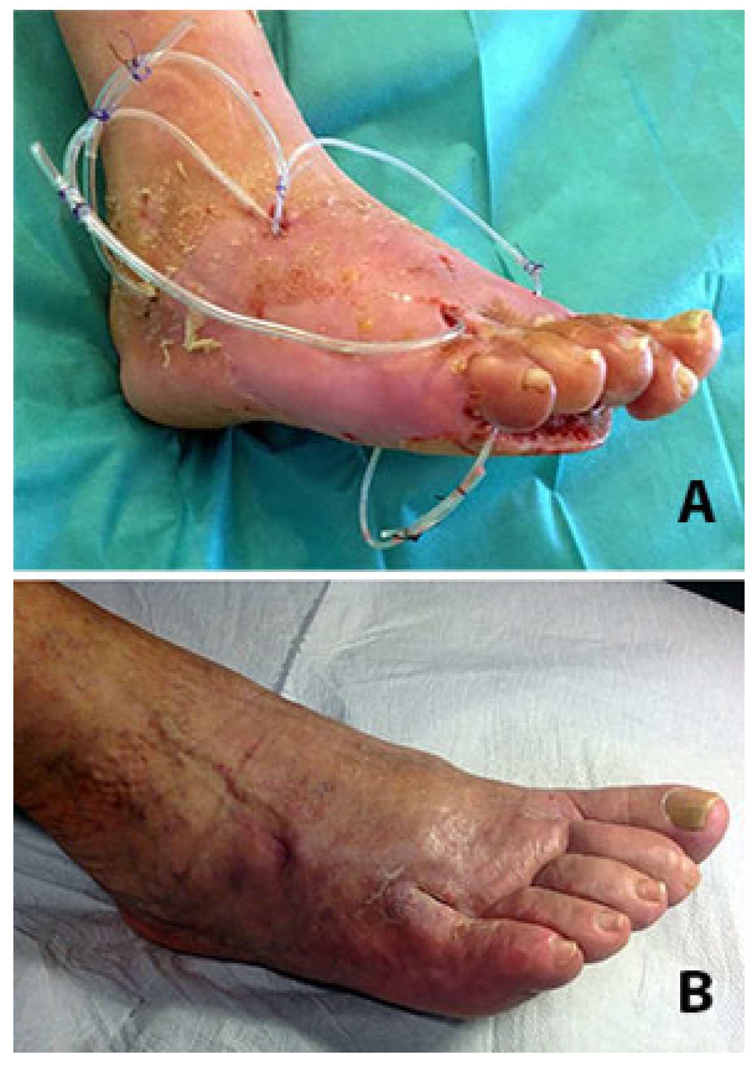 Jcm 14 03918 g014 Jcm 14 03918 g014