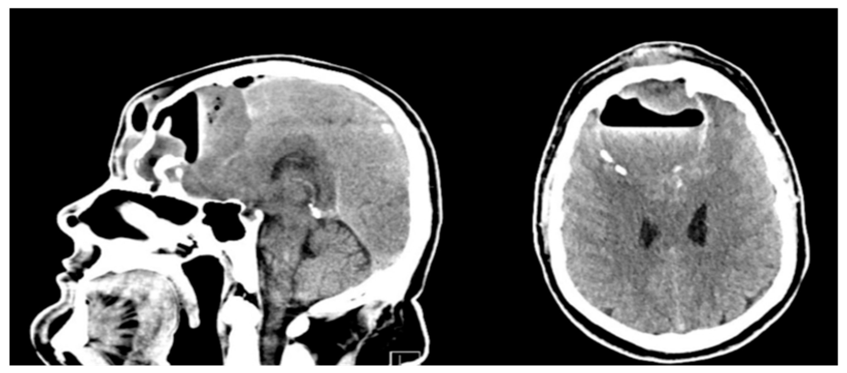 Jcm 14 04062 g001 Jcm 14 04062 g001