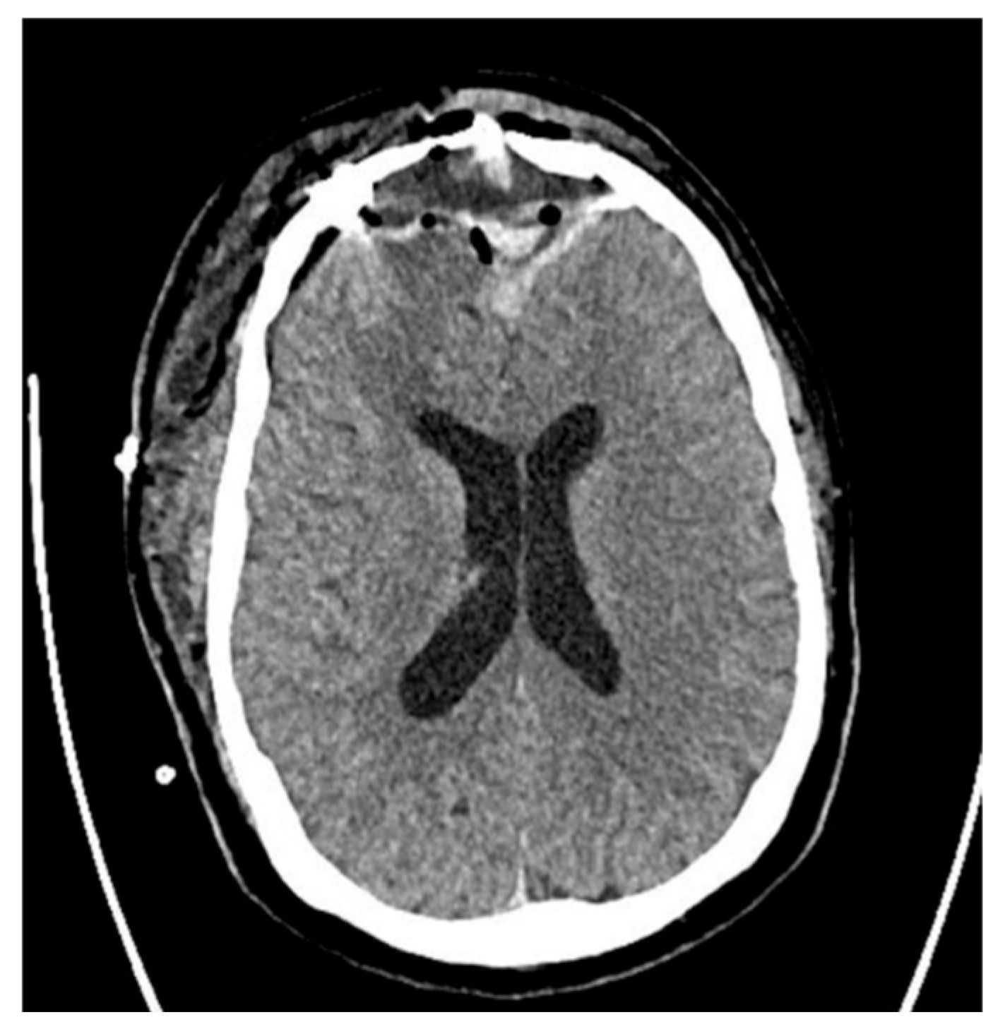 Jcm 14 04062 g002 Jcm 14 04062 g002