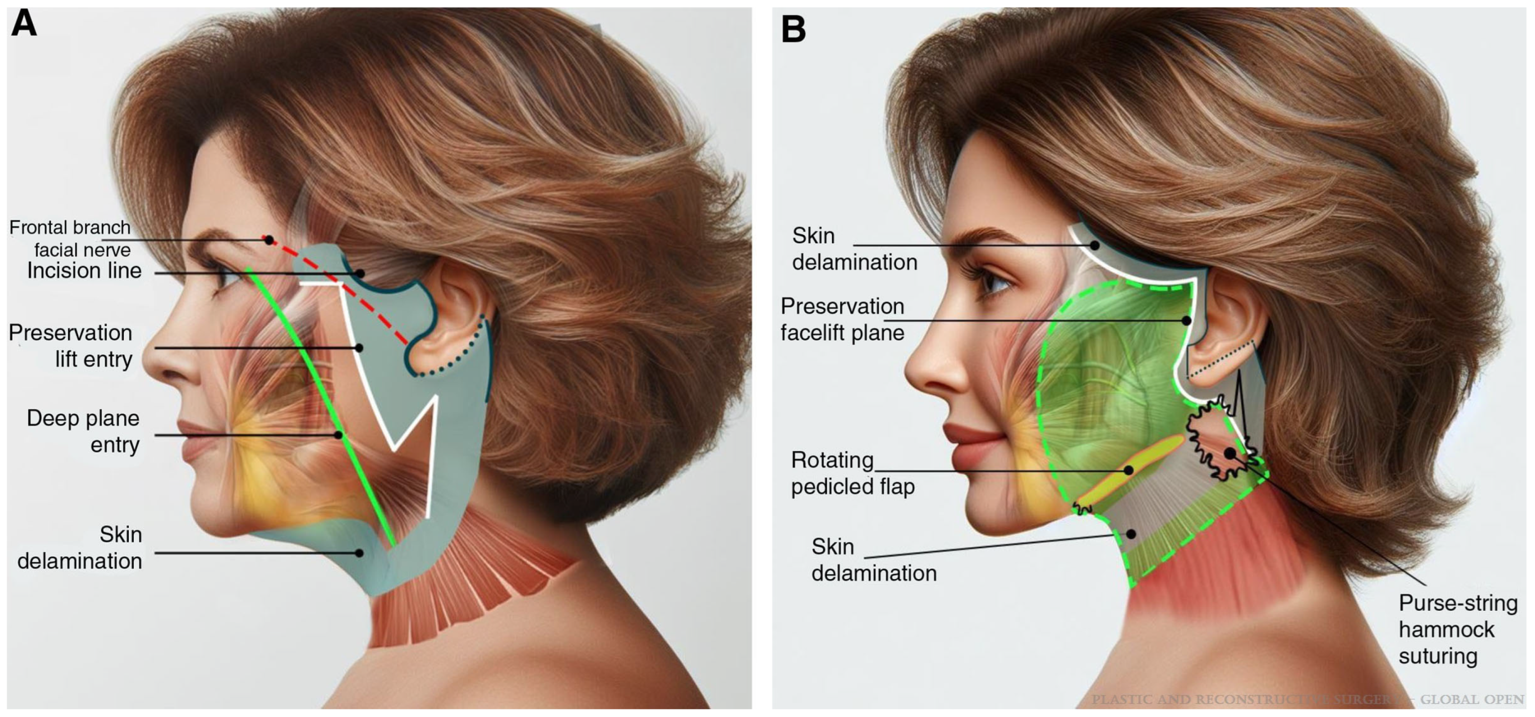 Jcm 14 04273 g001 Jcm 14 04273 g001