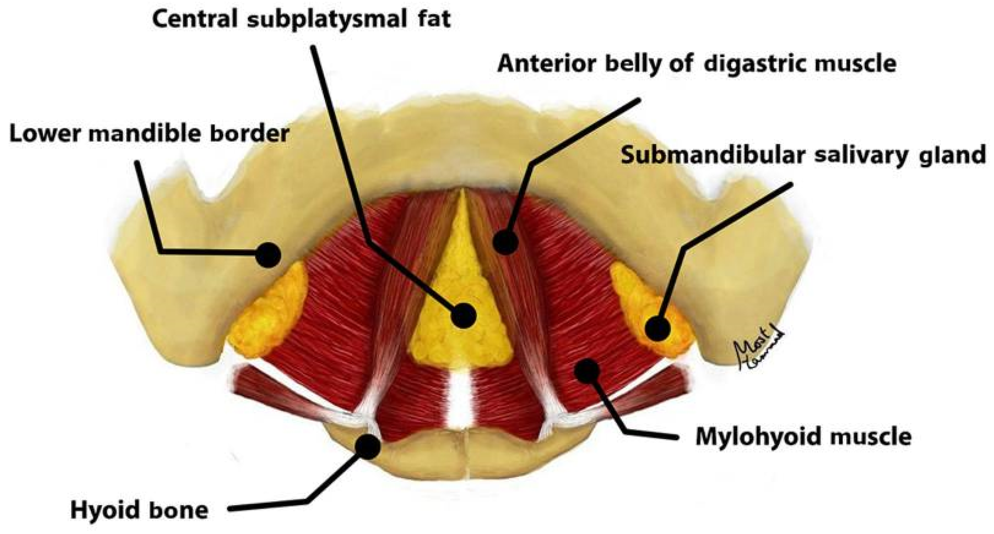 Jcm 14 04273 g004 Jcm 14 04273 g004