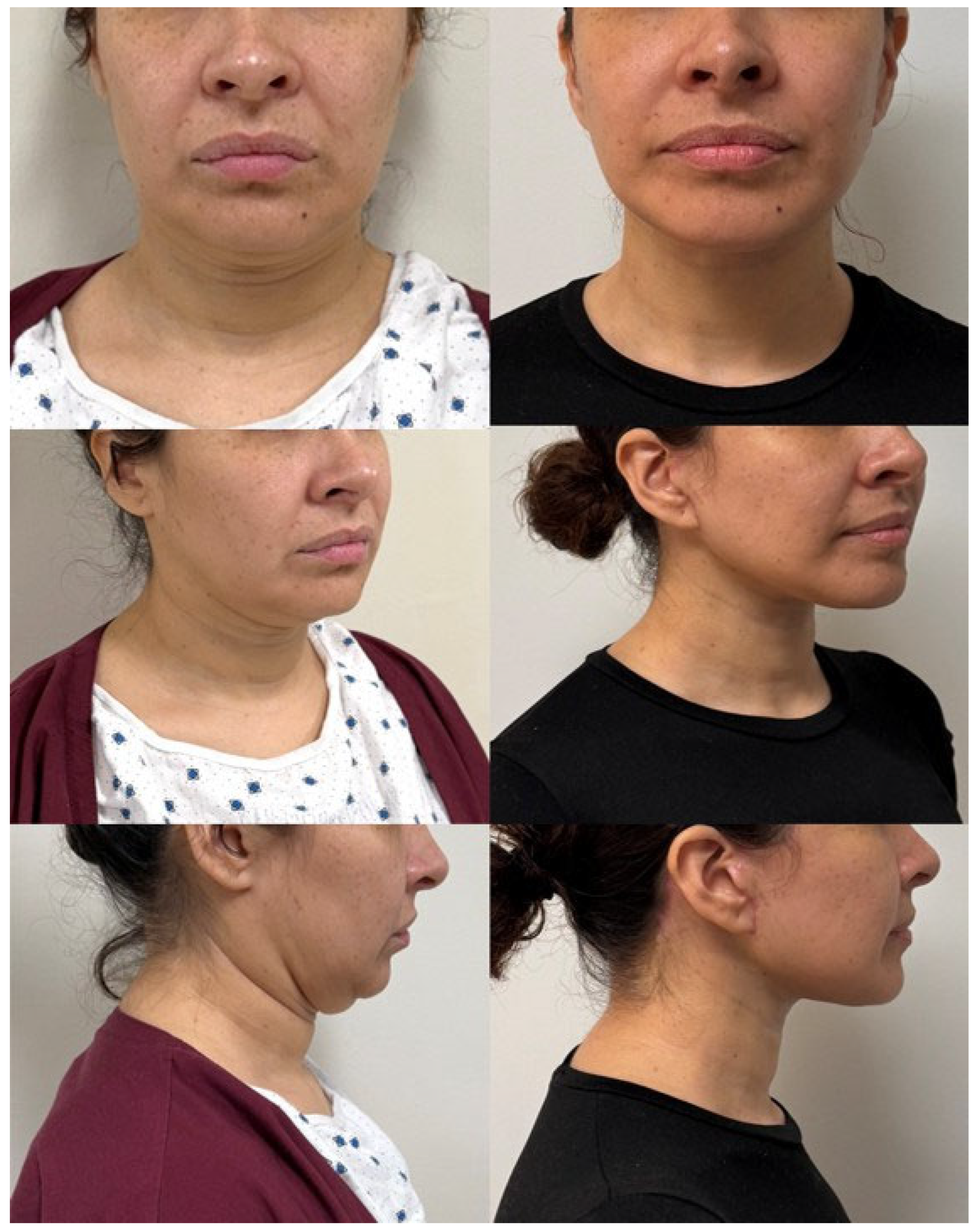 Jcm 14 04273 g005 Jcm 14 04273 g005