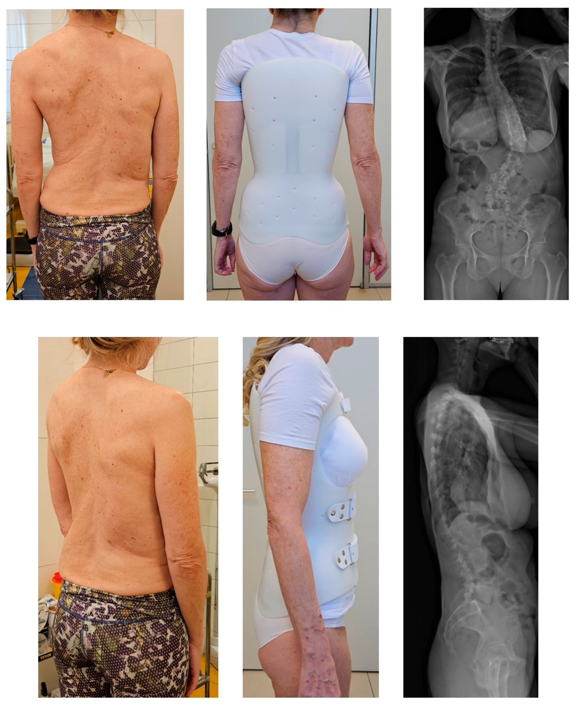 Jcm 14 04493 g001 Jcm 14 04493 g001