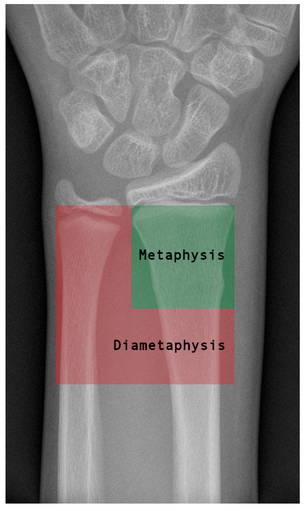 Jcm 14 04626 g001 Jcm 14 04626 g001