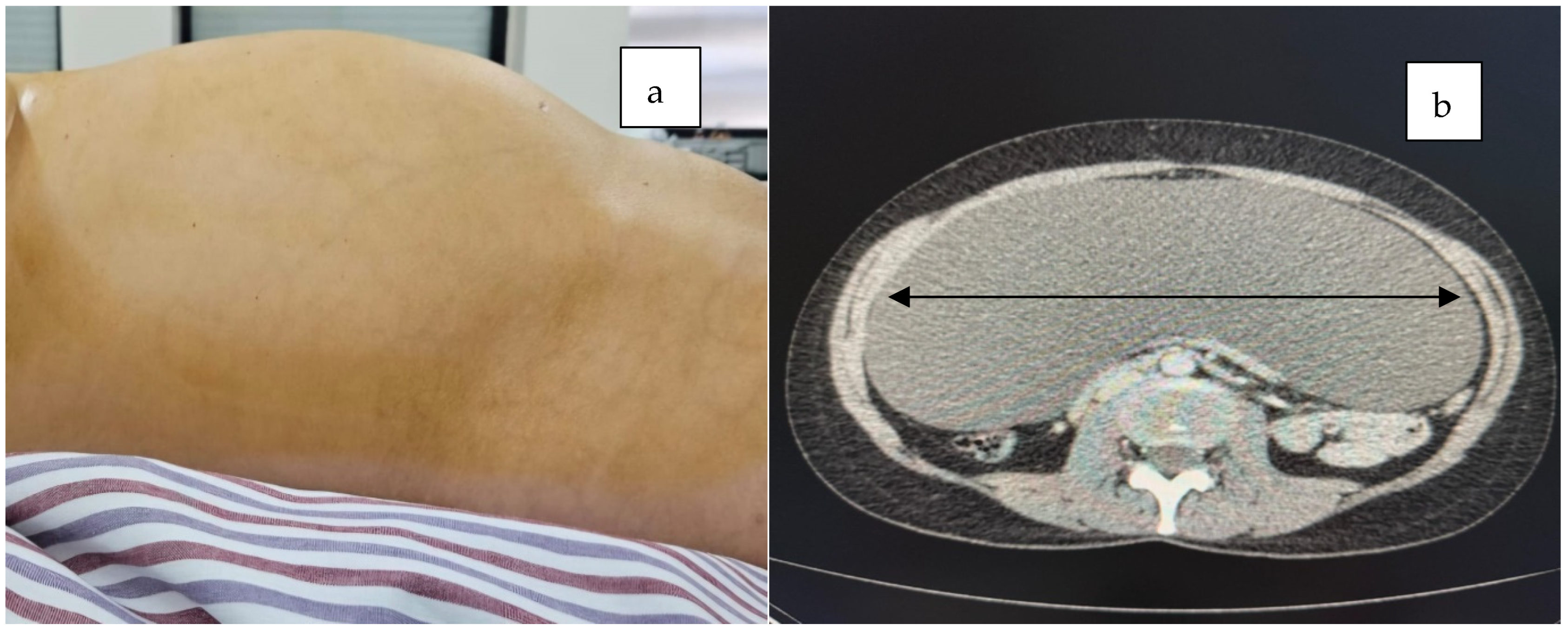 Jcm 14 04888 g001 Jcm 14 04888 g001