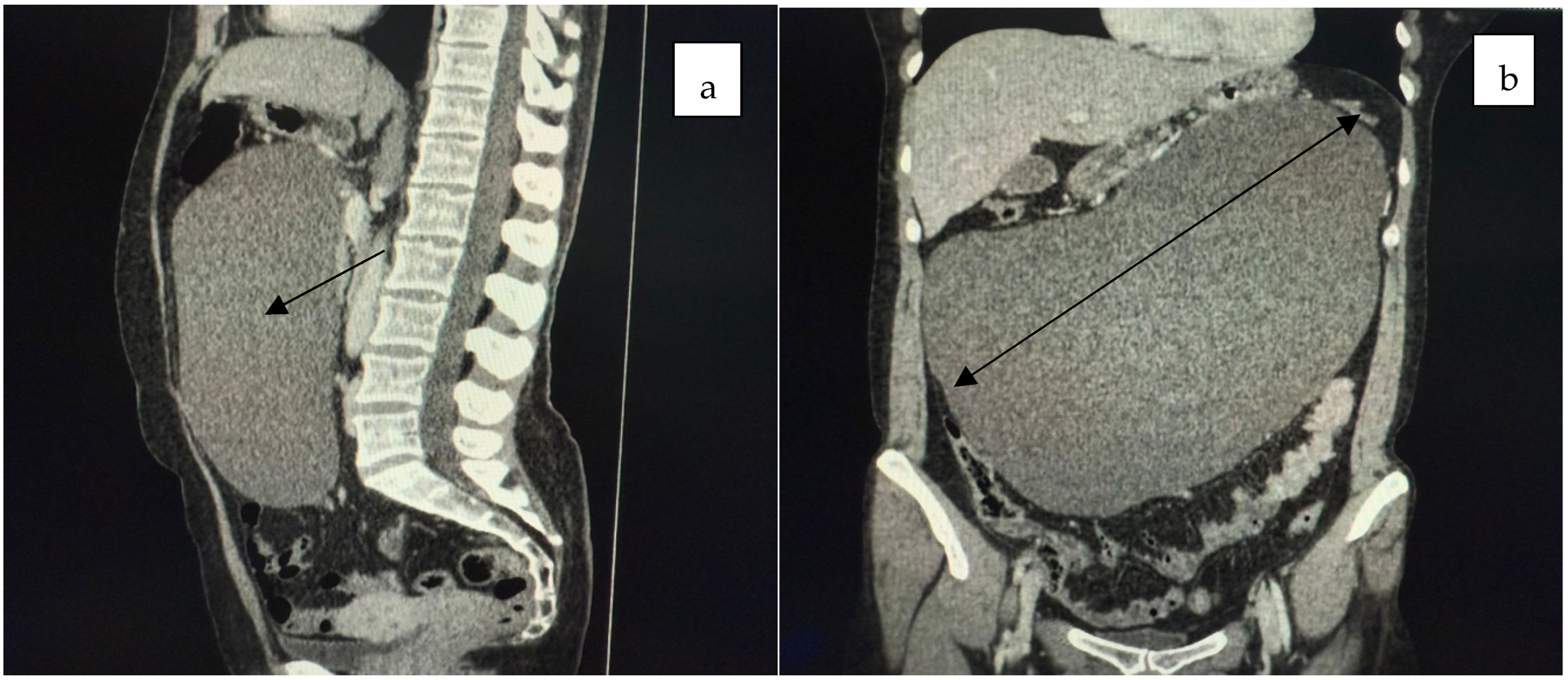 Jcm 14 04888 g002 Jcm 14 04888 g002