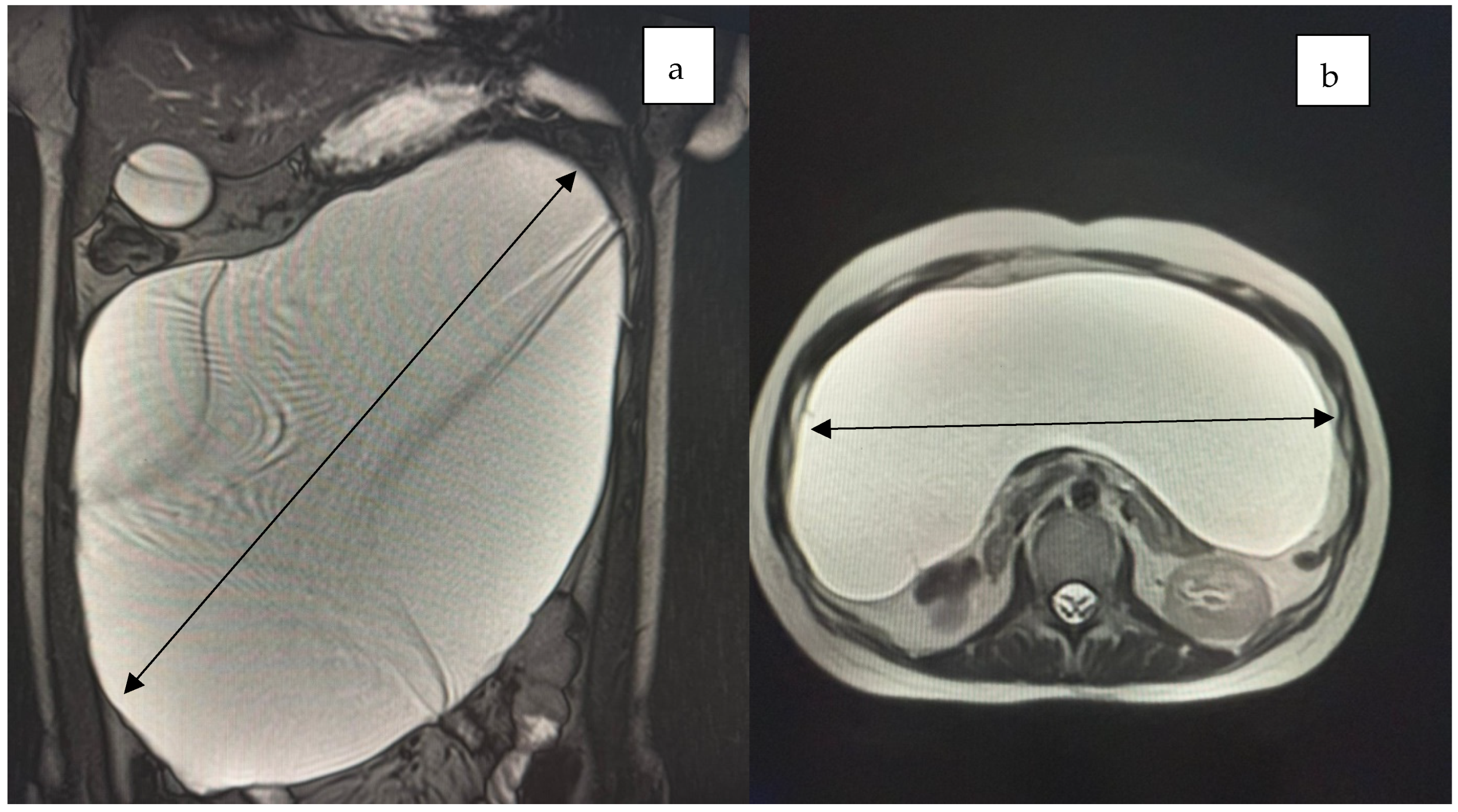 Jcm 14 04888 g003 Jcm 14 04888 g003