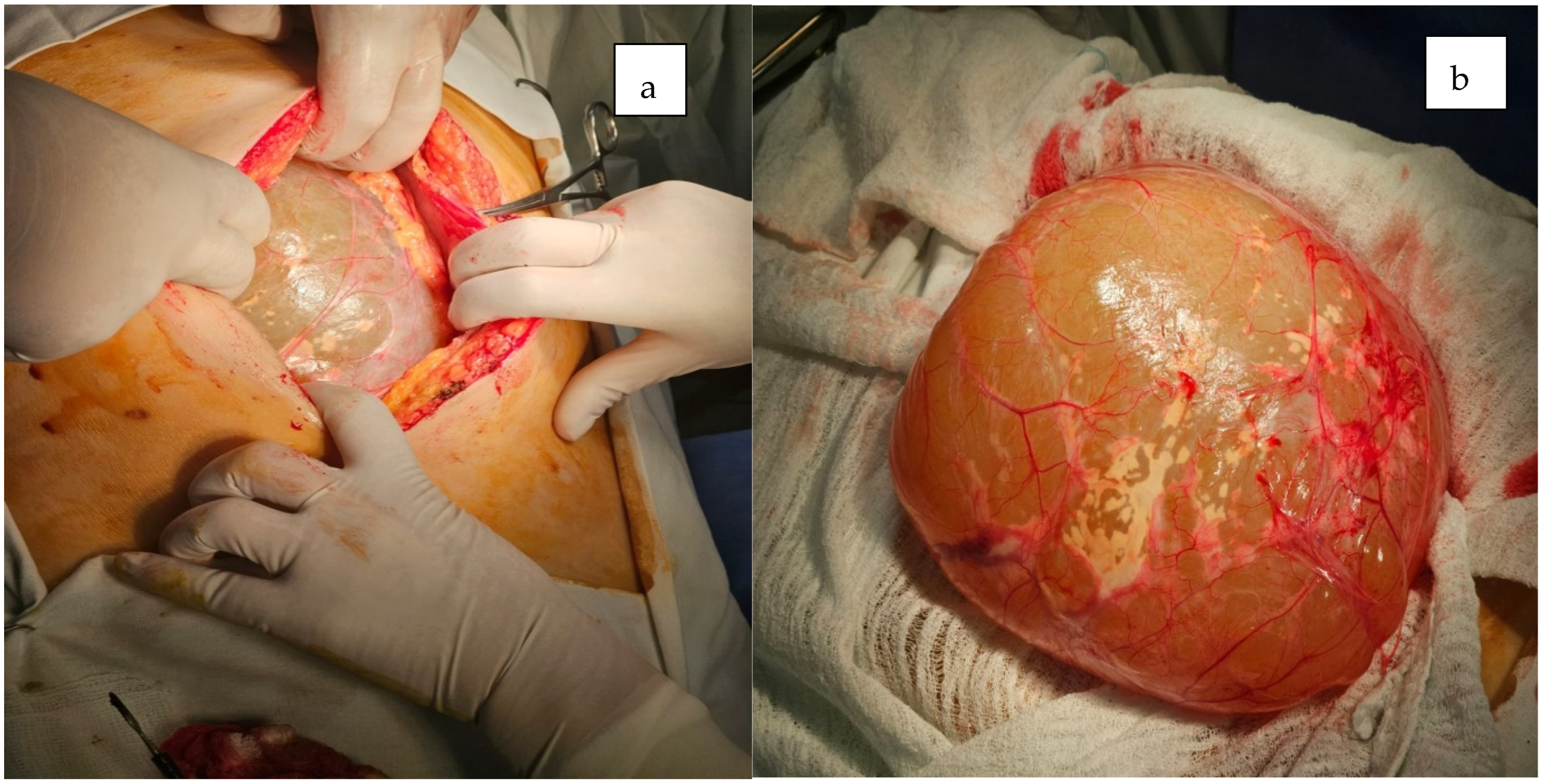 Jcm 14 04888 g004 Jcm 14 04888 g004