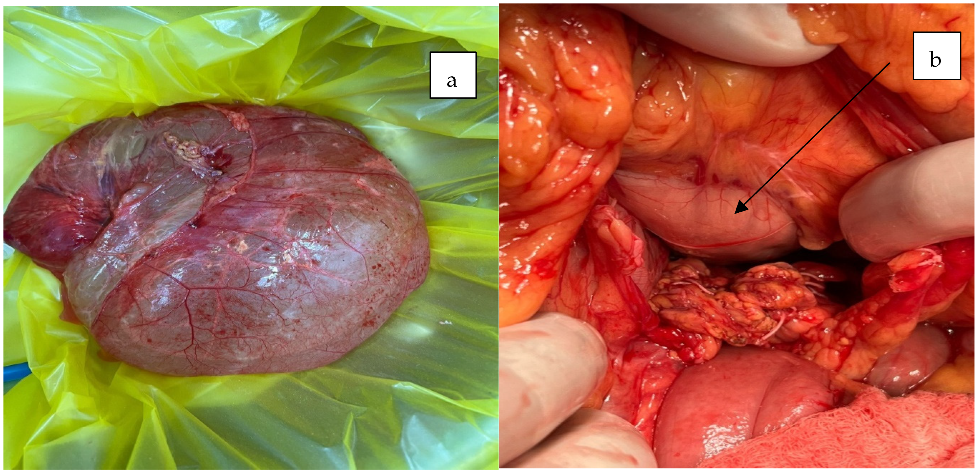 Jcm 14 04888 g005 Jcm 14 04888 g005